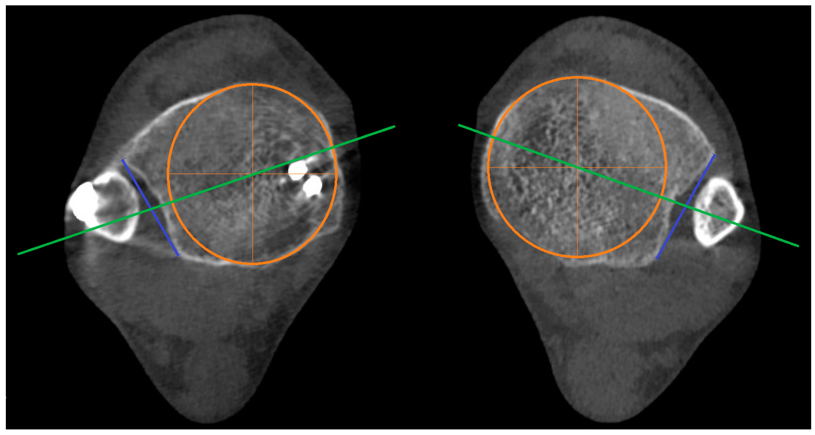 Diagnostics 15 00750 g002