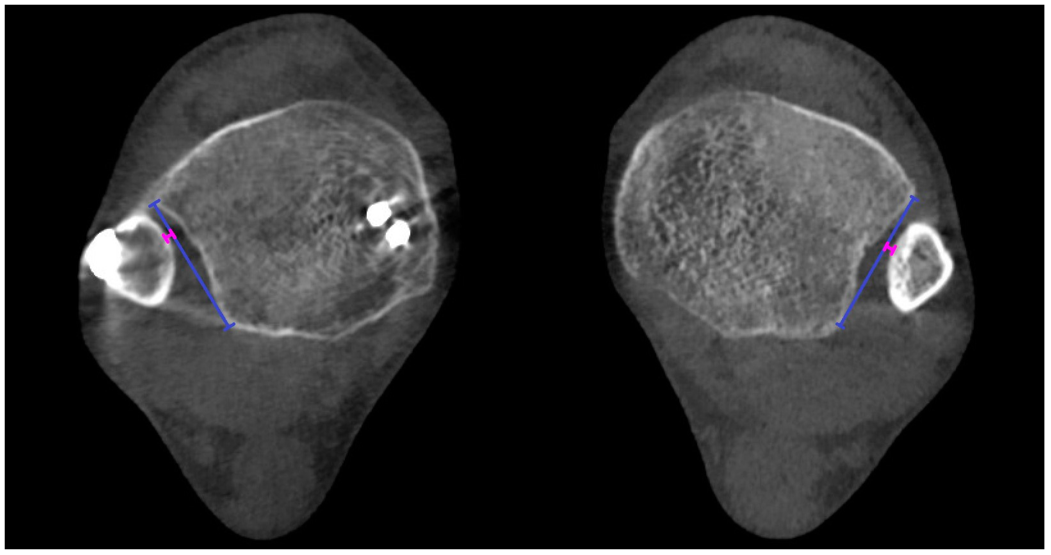 Diagnostics 15 00750 g004