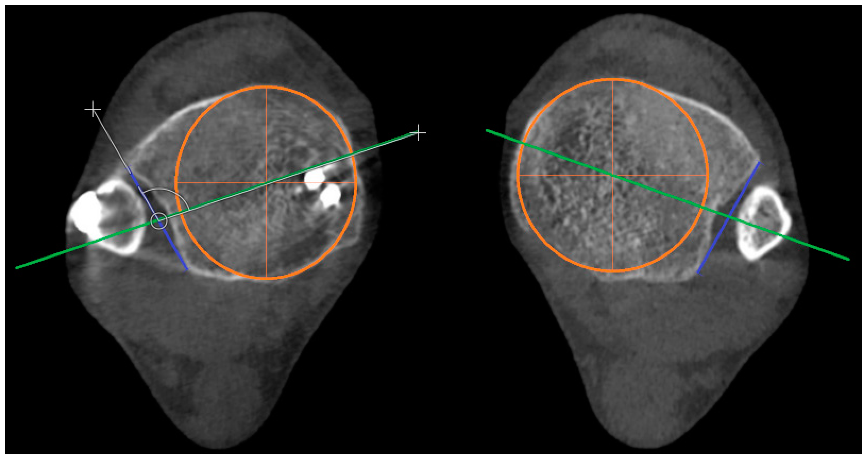 Diagnostics 15 00750 g005