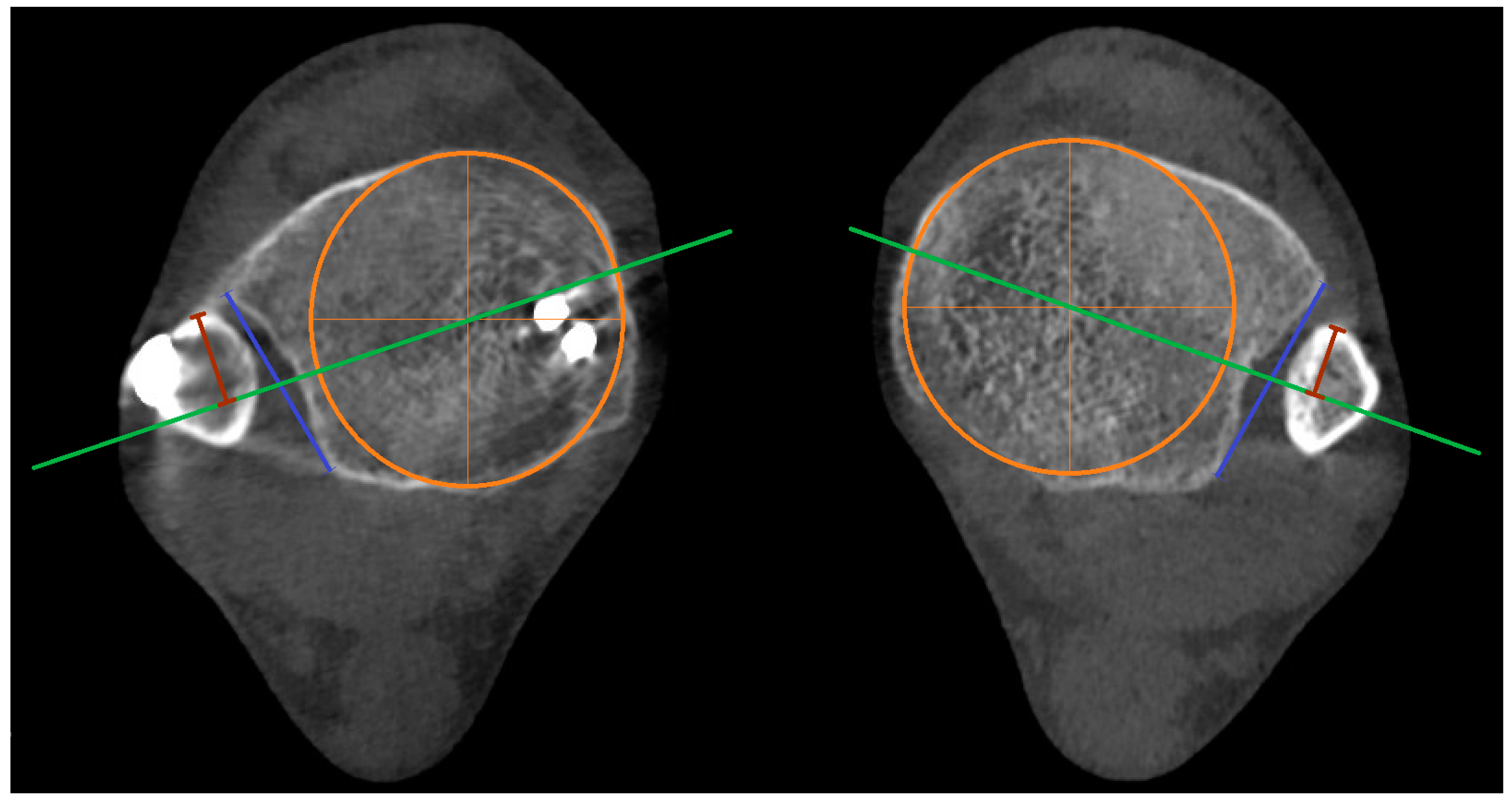 Diagnostics 15 00750 g006