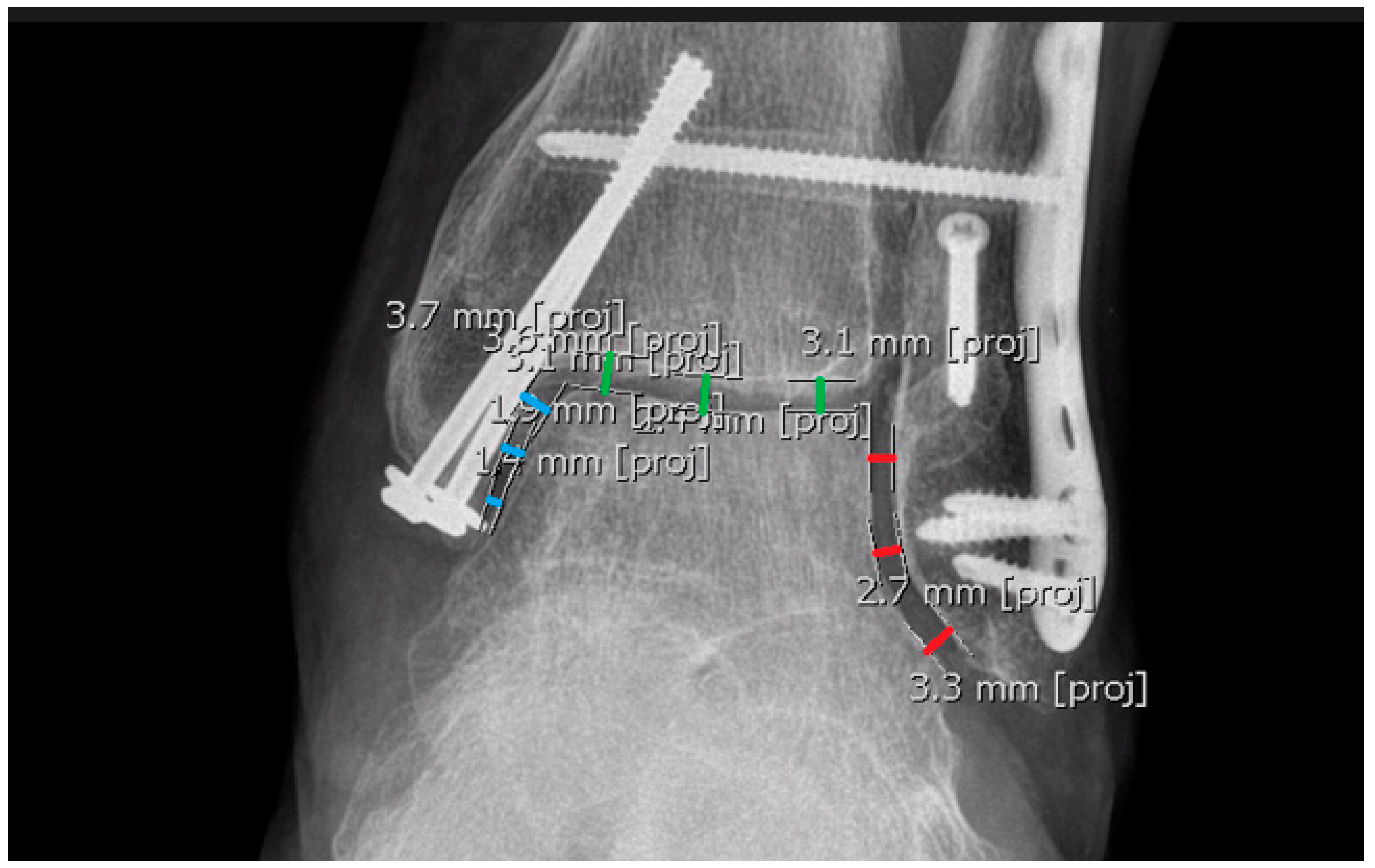 Diagnostics 15 00750 g010