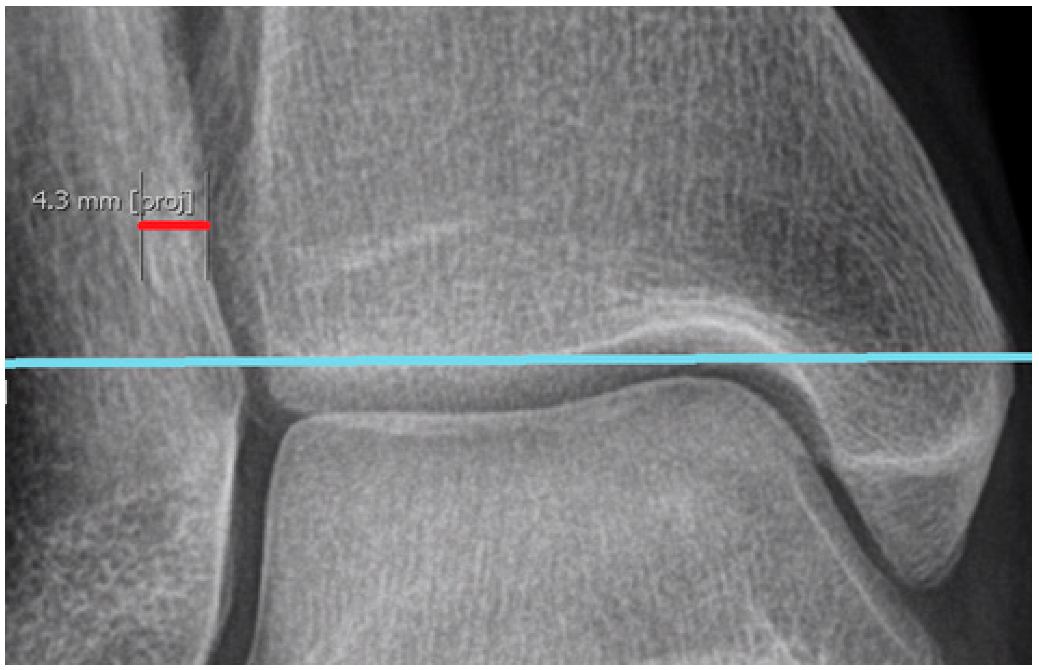 Diagnostics 15 00750 g011