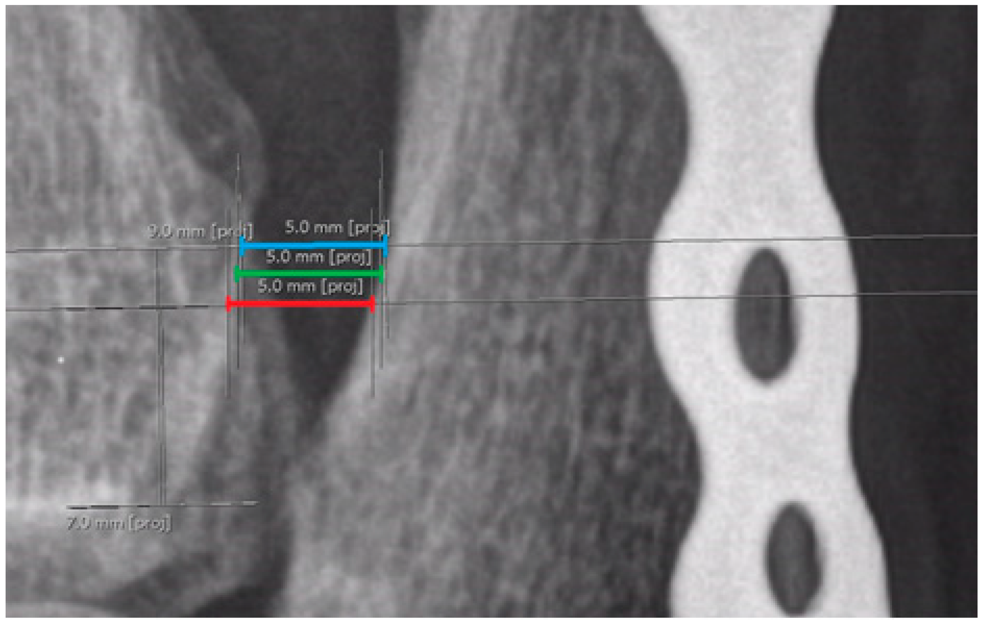 Diagnostics 15 00750 g012