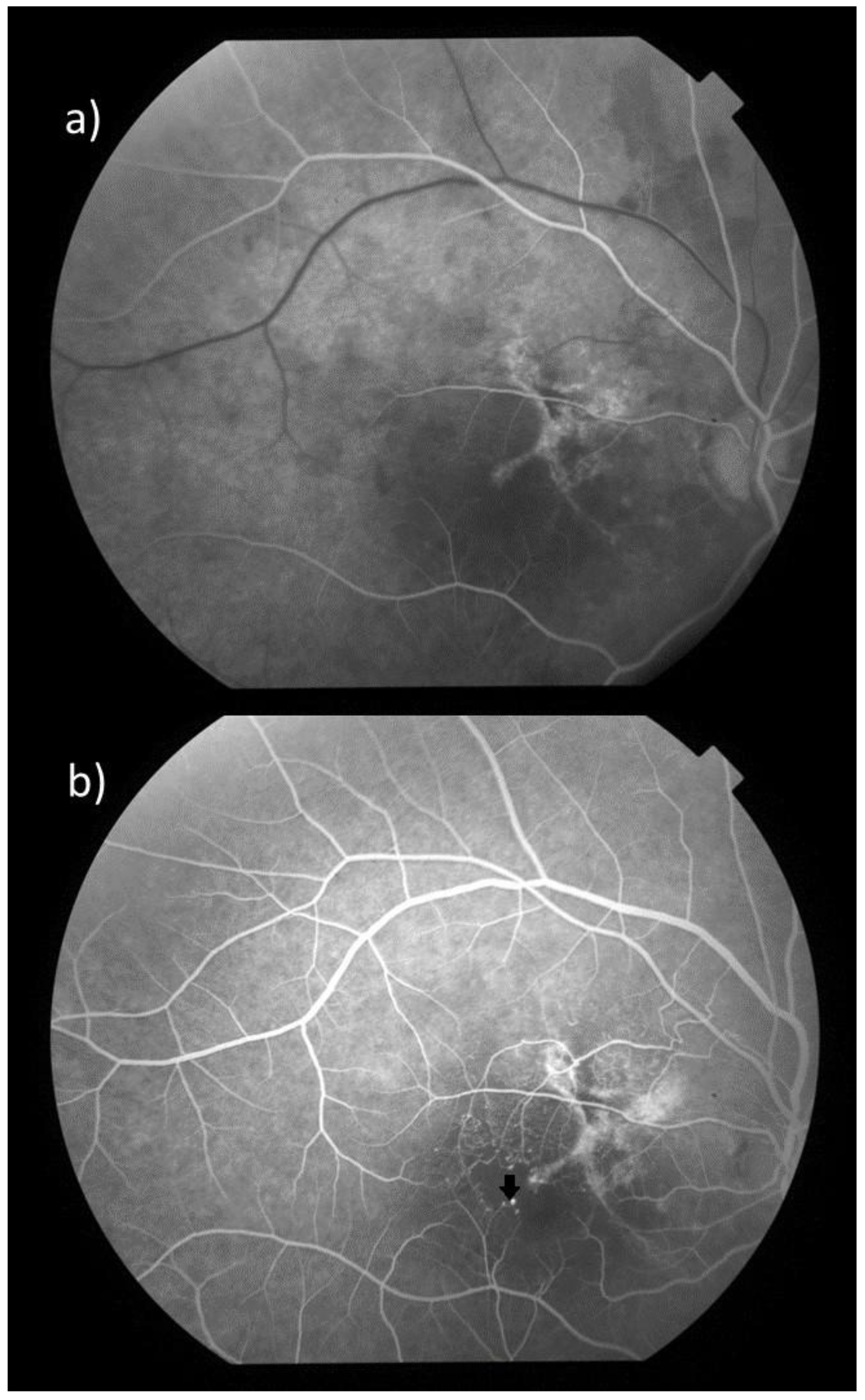 Diagnostics 15 00754 g002