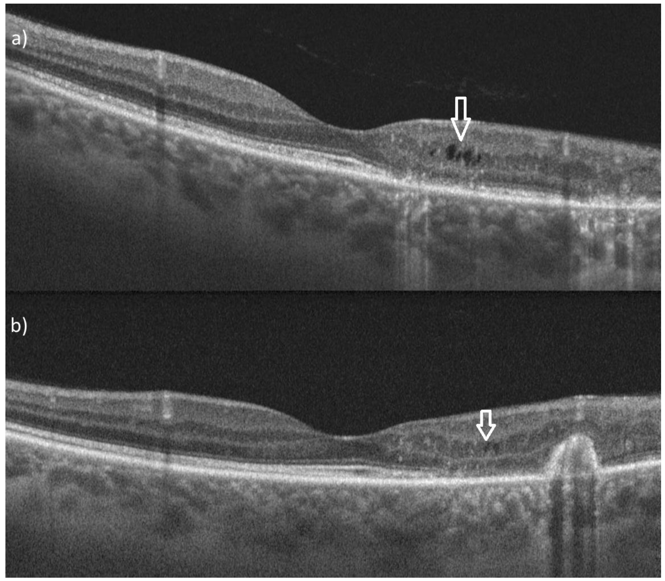 Diagnostics 15 00754 g003