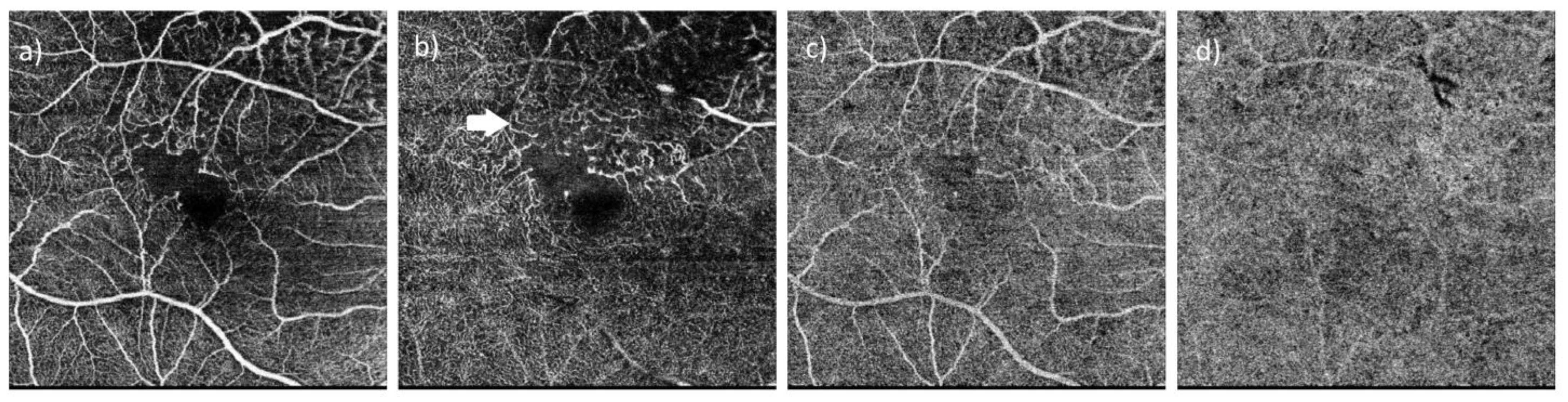 Diagnostics 15 00754 g004