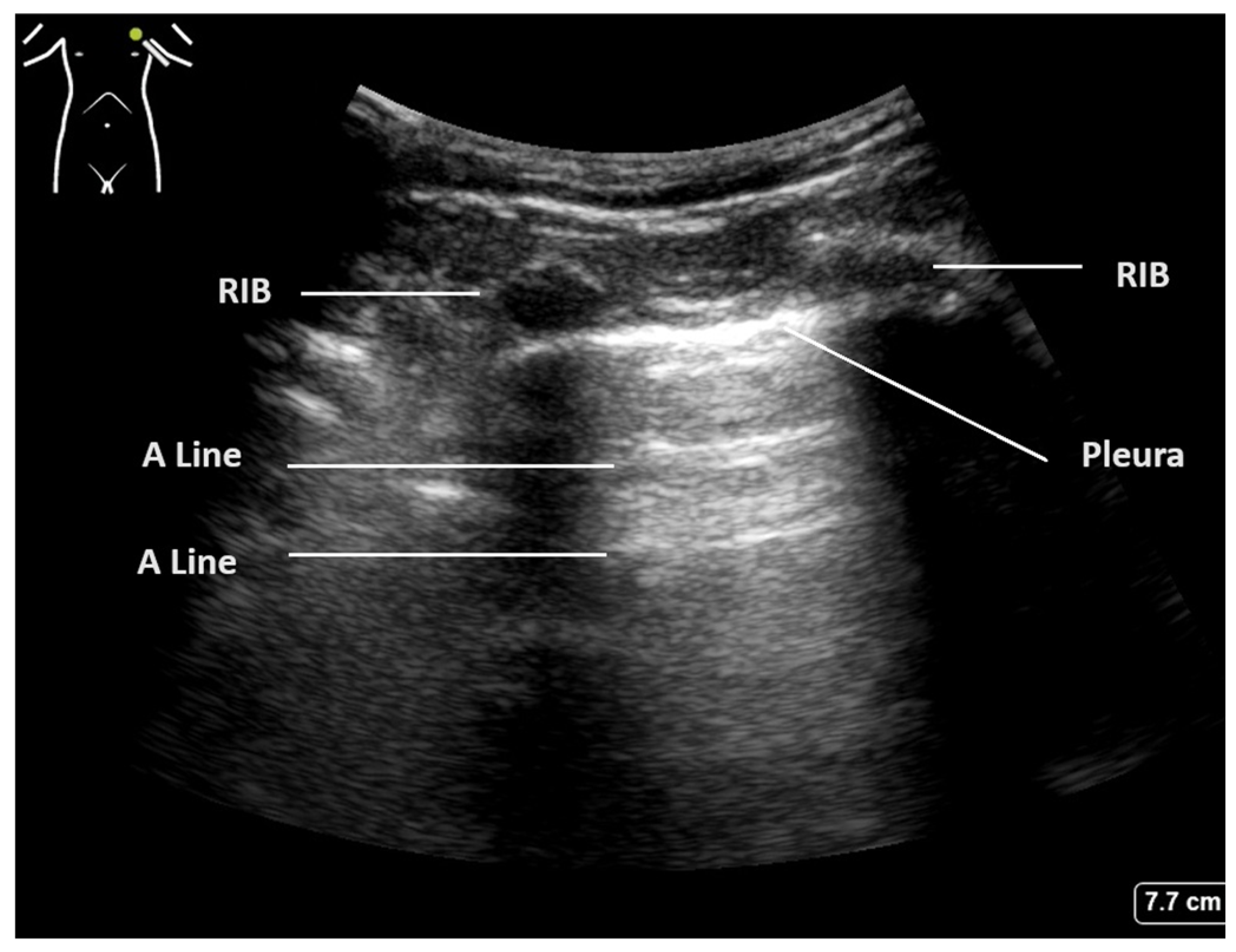 Diagnostics 15 00755 g001 Diagnostics 15 00755 g001