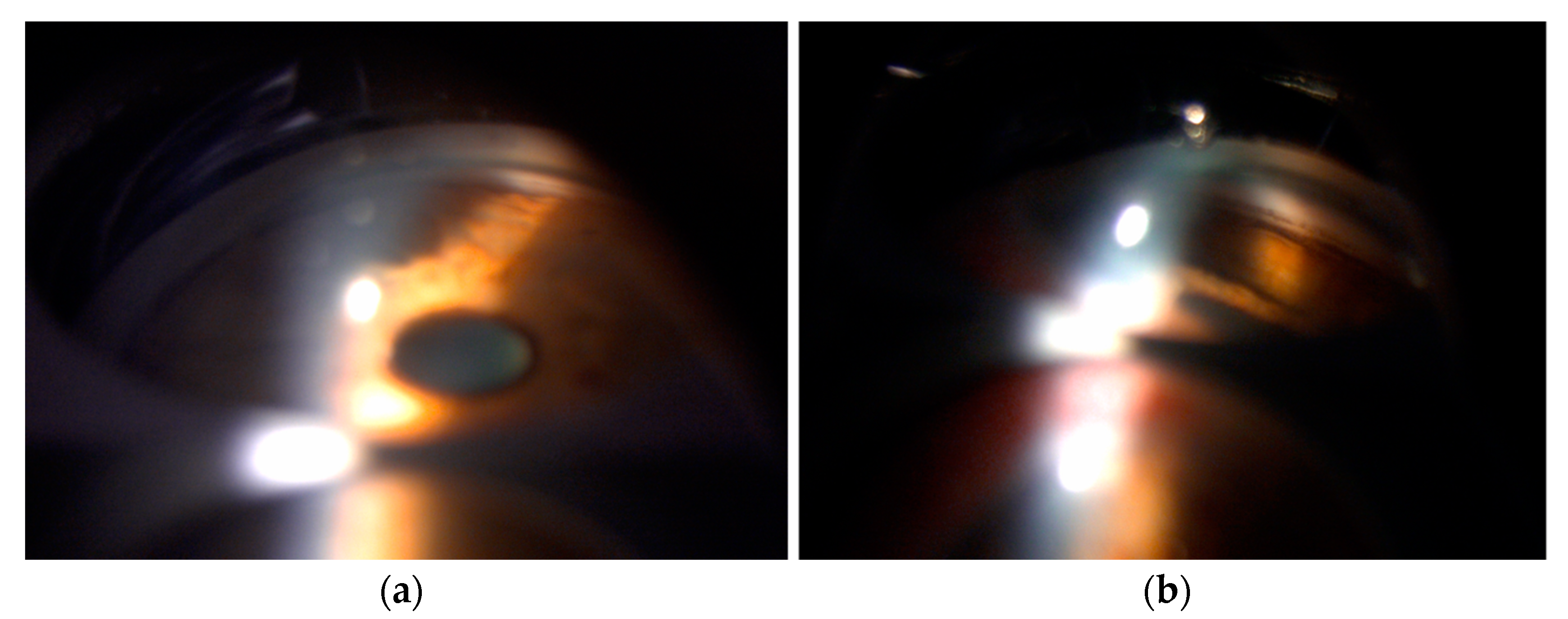 Diagnostics 15 00758 g003