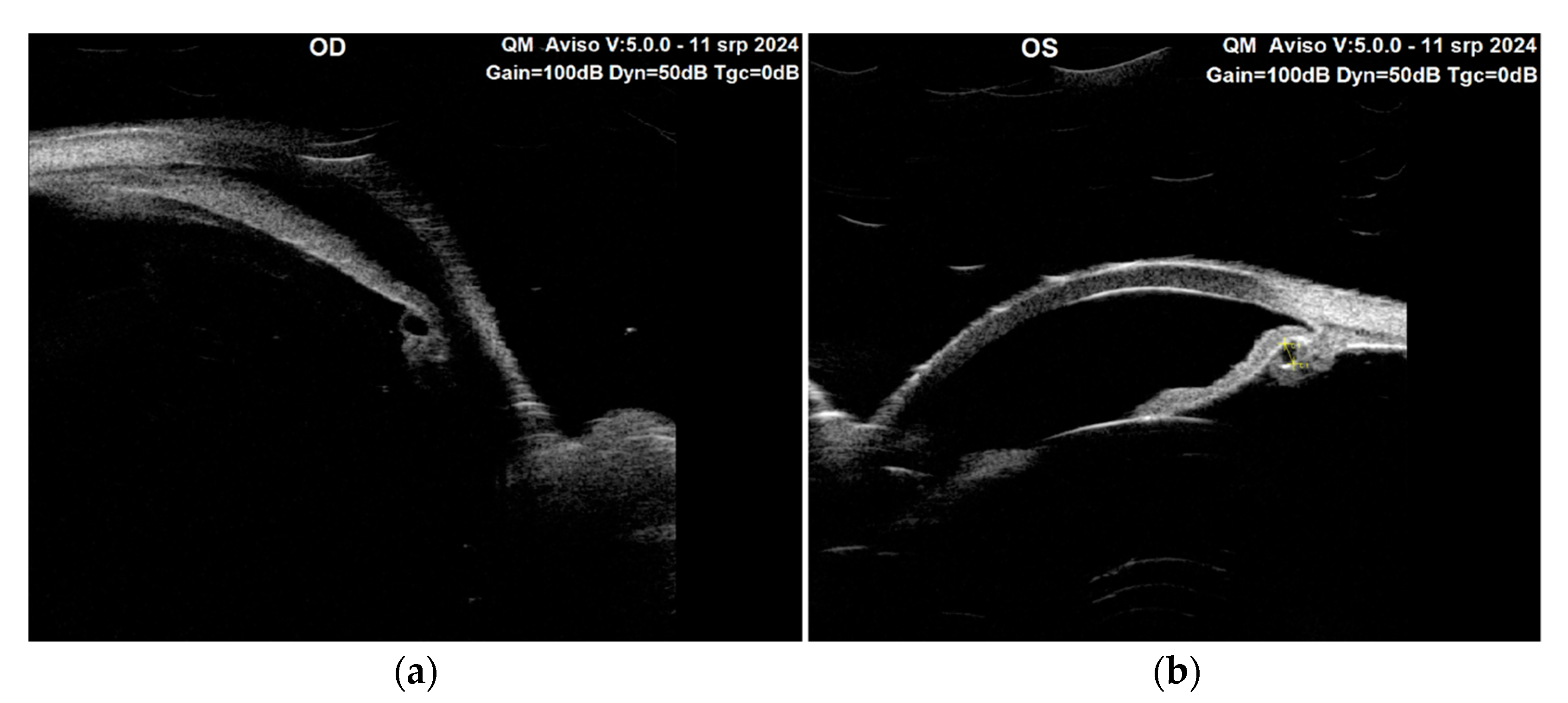 Diagnostics 15 00758 g004