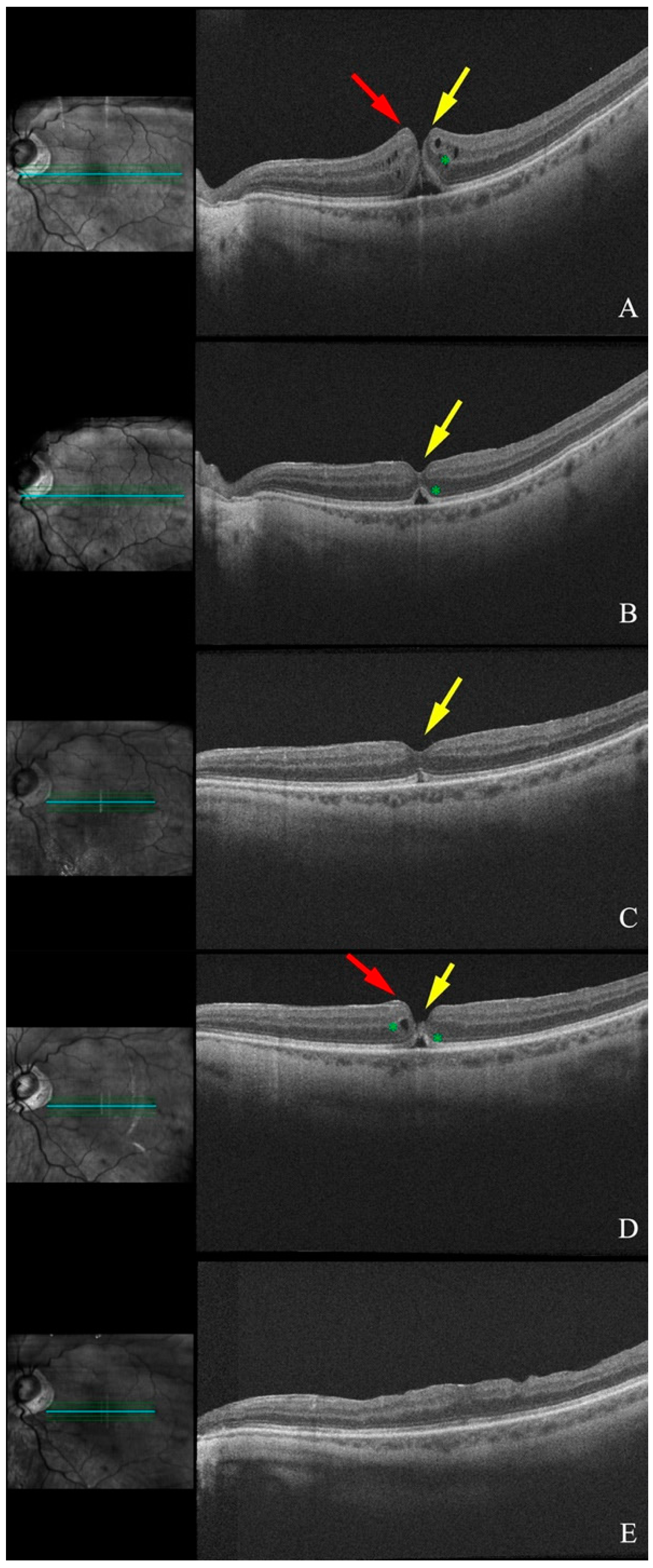 Diagnostics 15 00759 g001