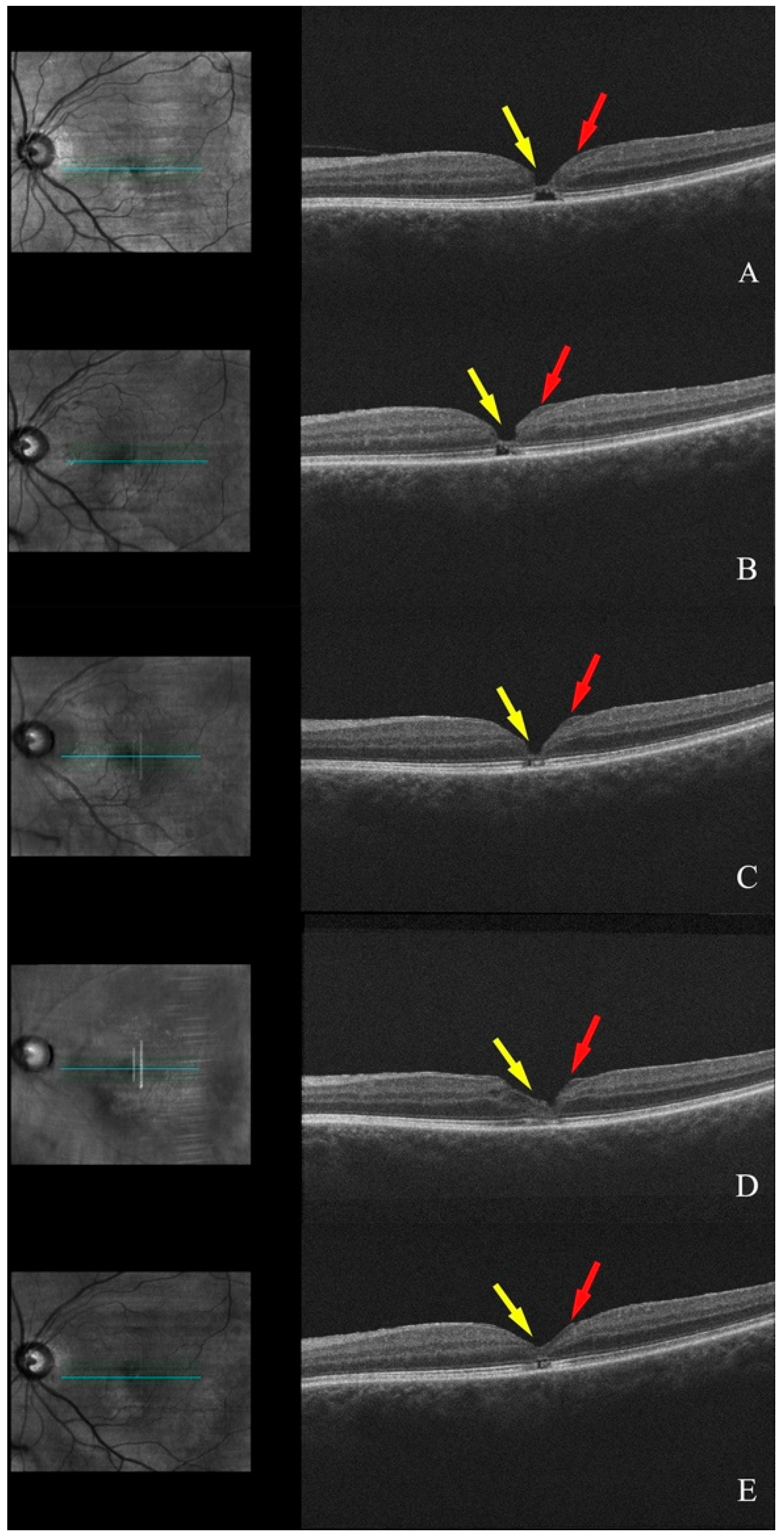 Diagnostics 15 00759 g002