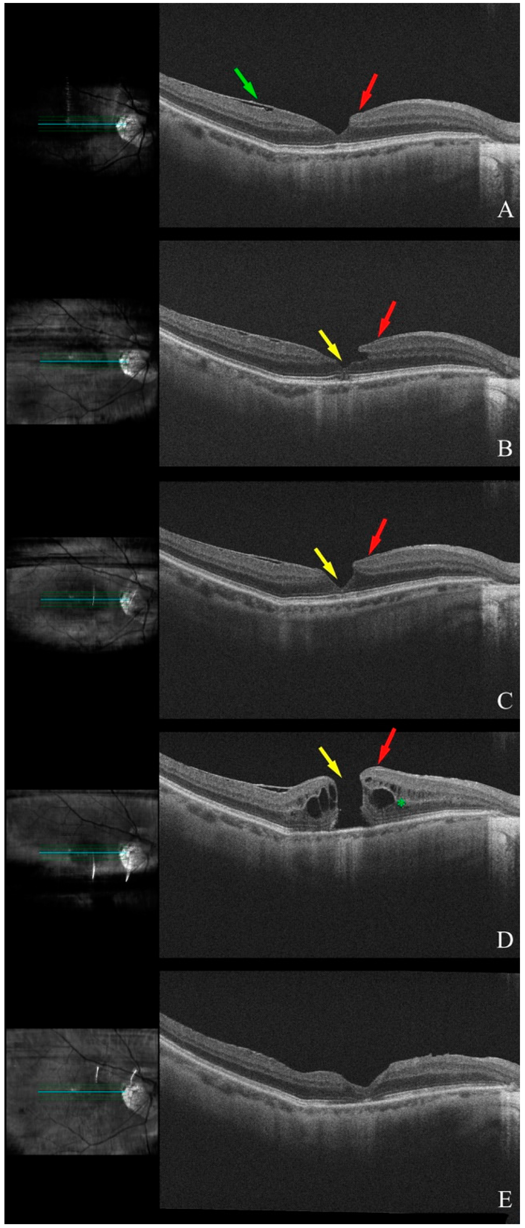 Diagnostics 15 00759 g003