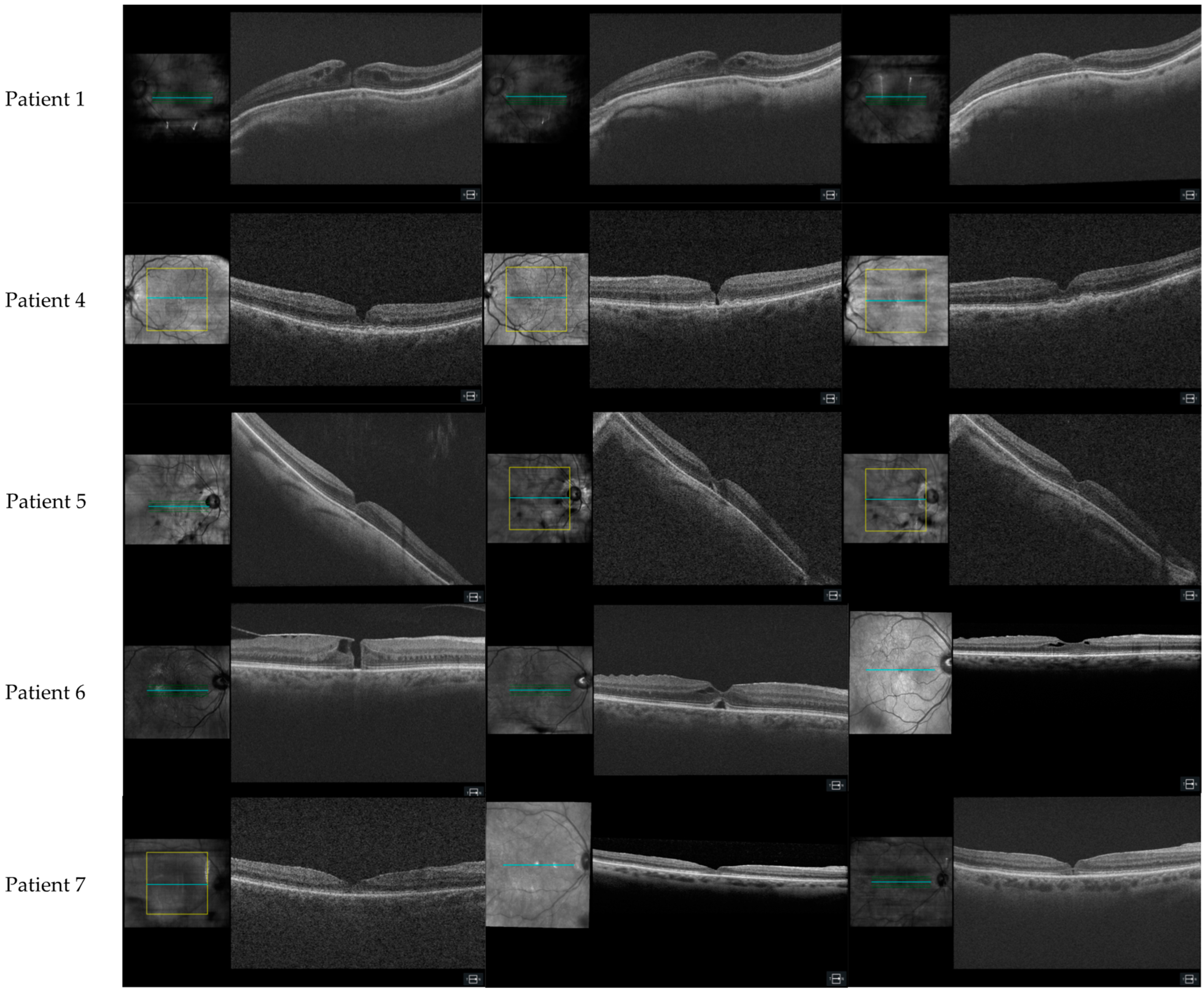 Diagnostics 15 00759 g0a1