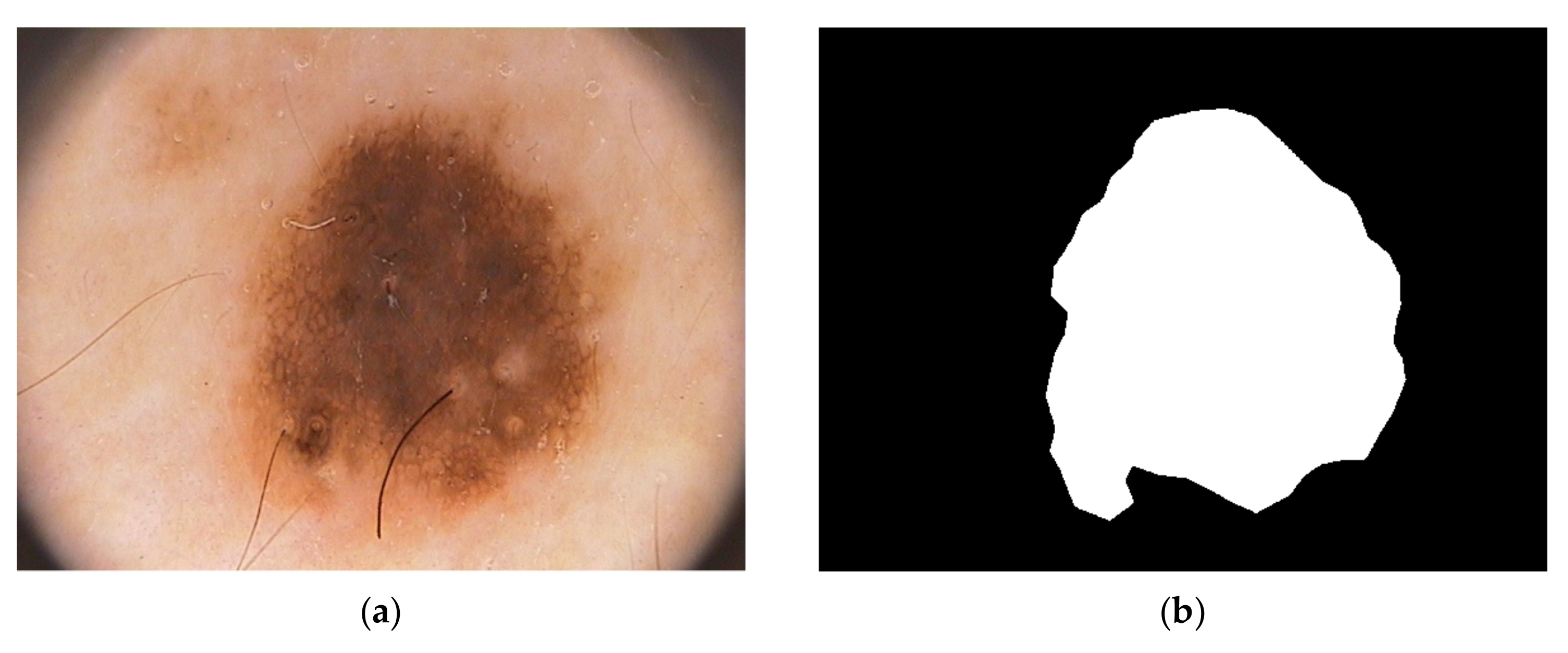 Diagnostics 15 00761 g001