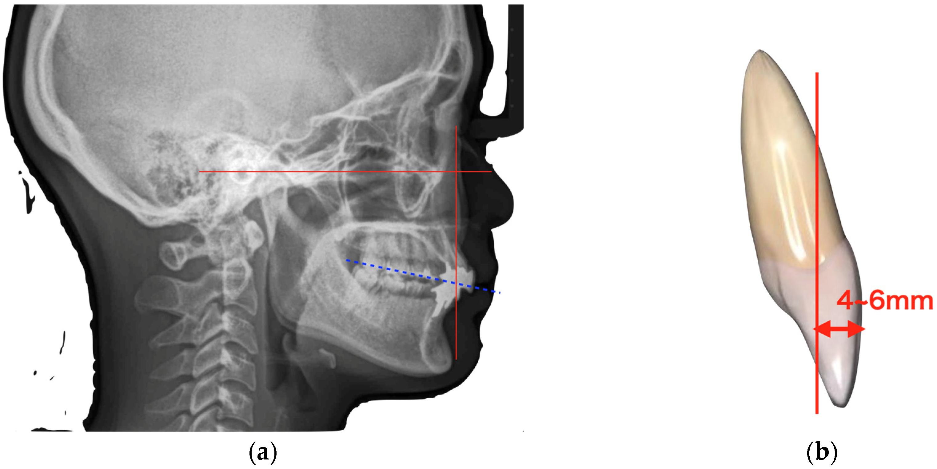 Diagnostics 15 00765 g004
