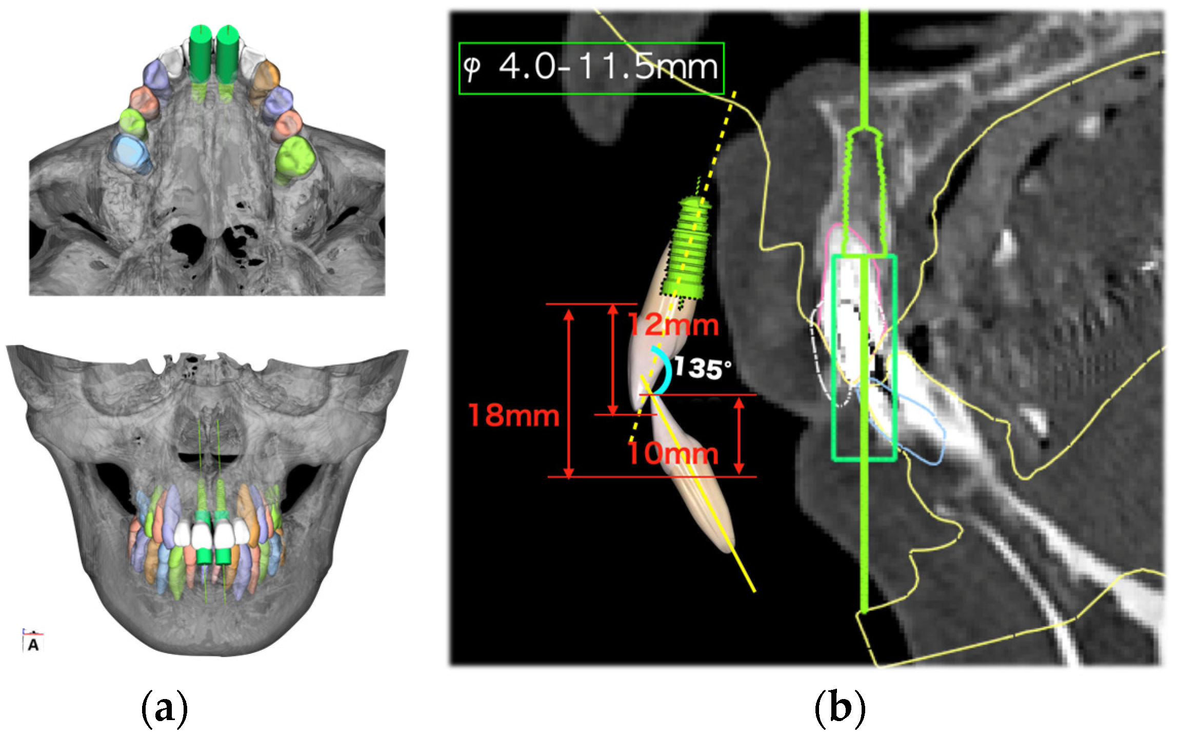 Diagnostics 15 00765 g005