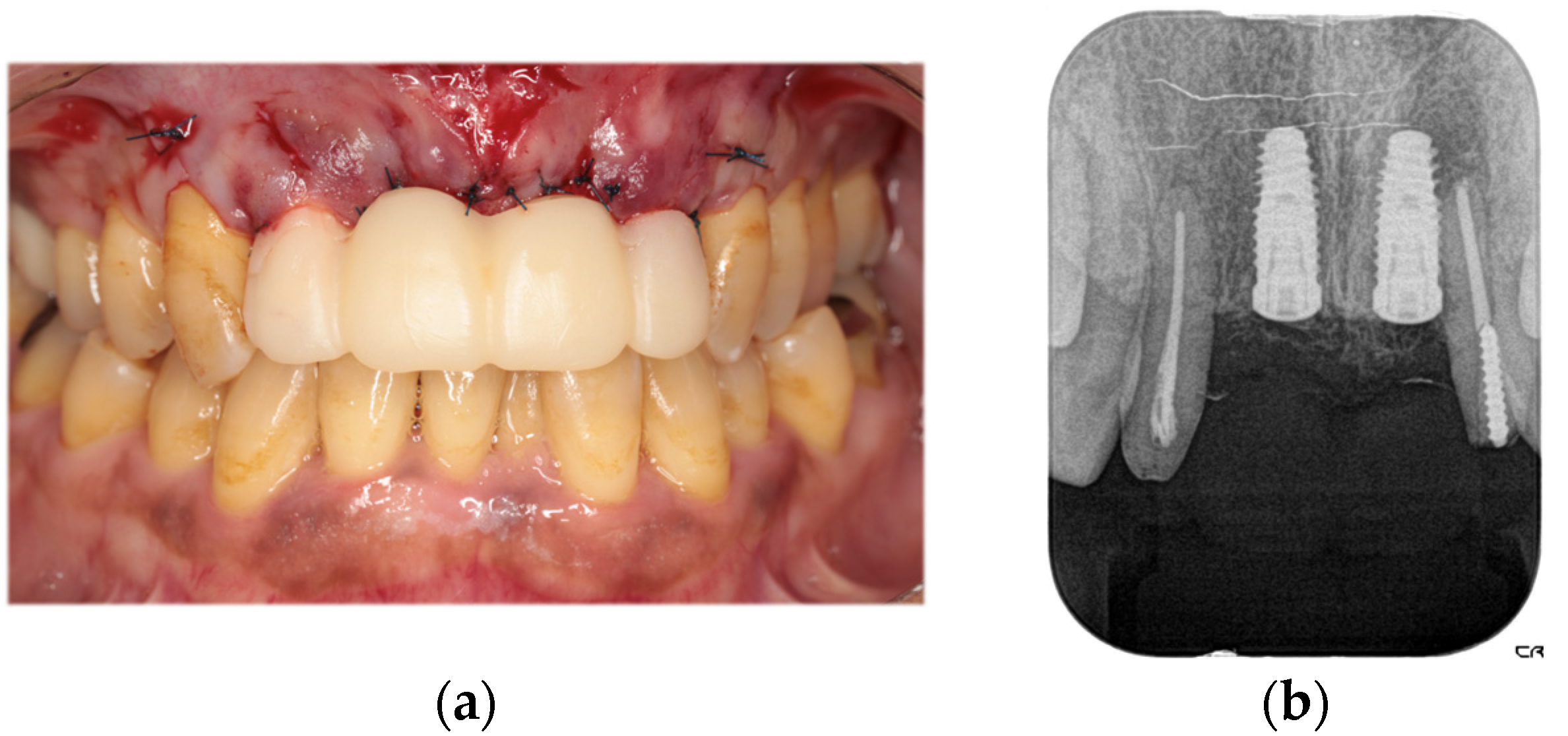 Diagnostics 15 00765 g008