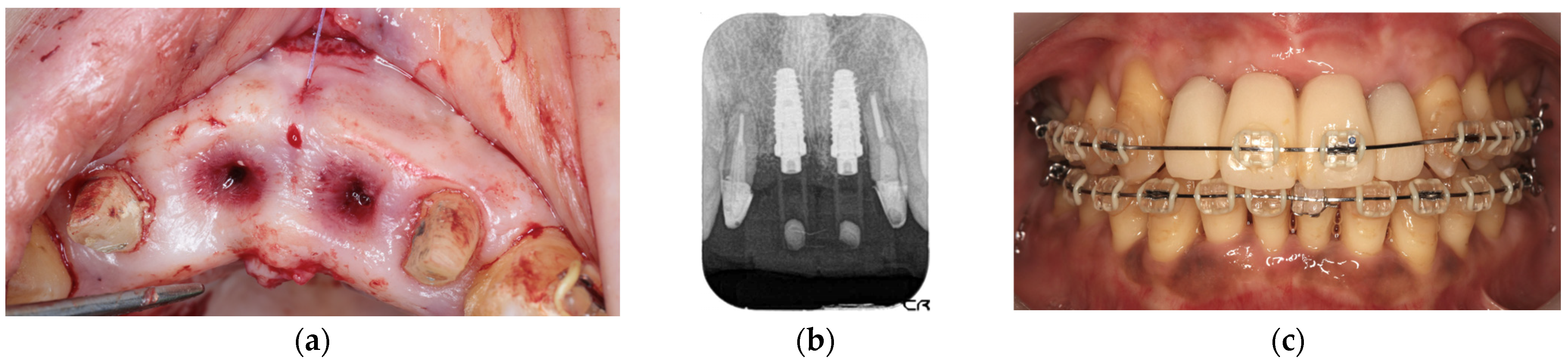 Diagnostics 15 00765 g009