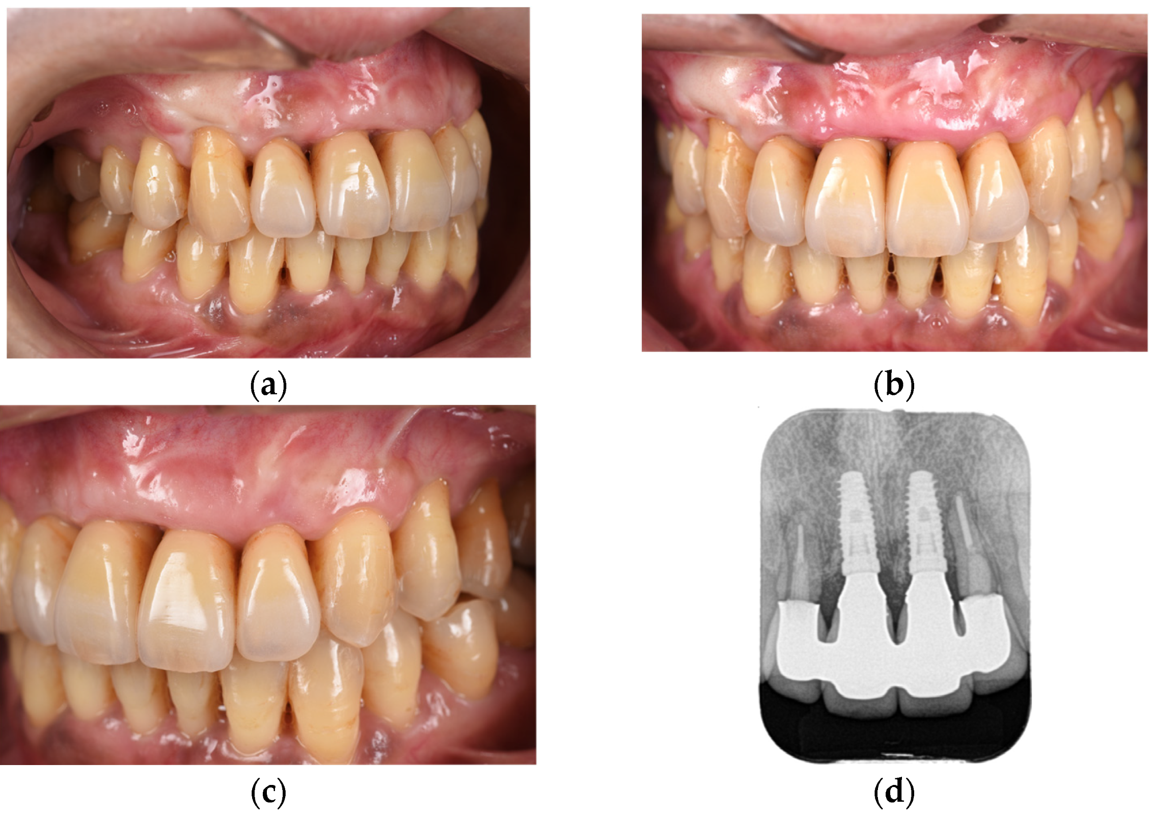 Diagnostics 15 00765 g010