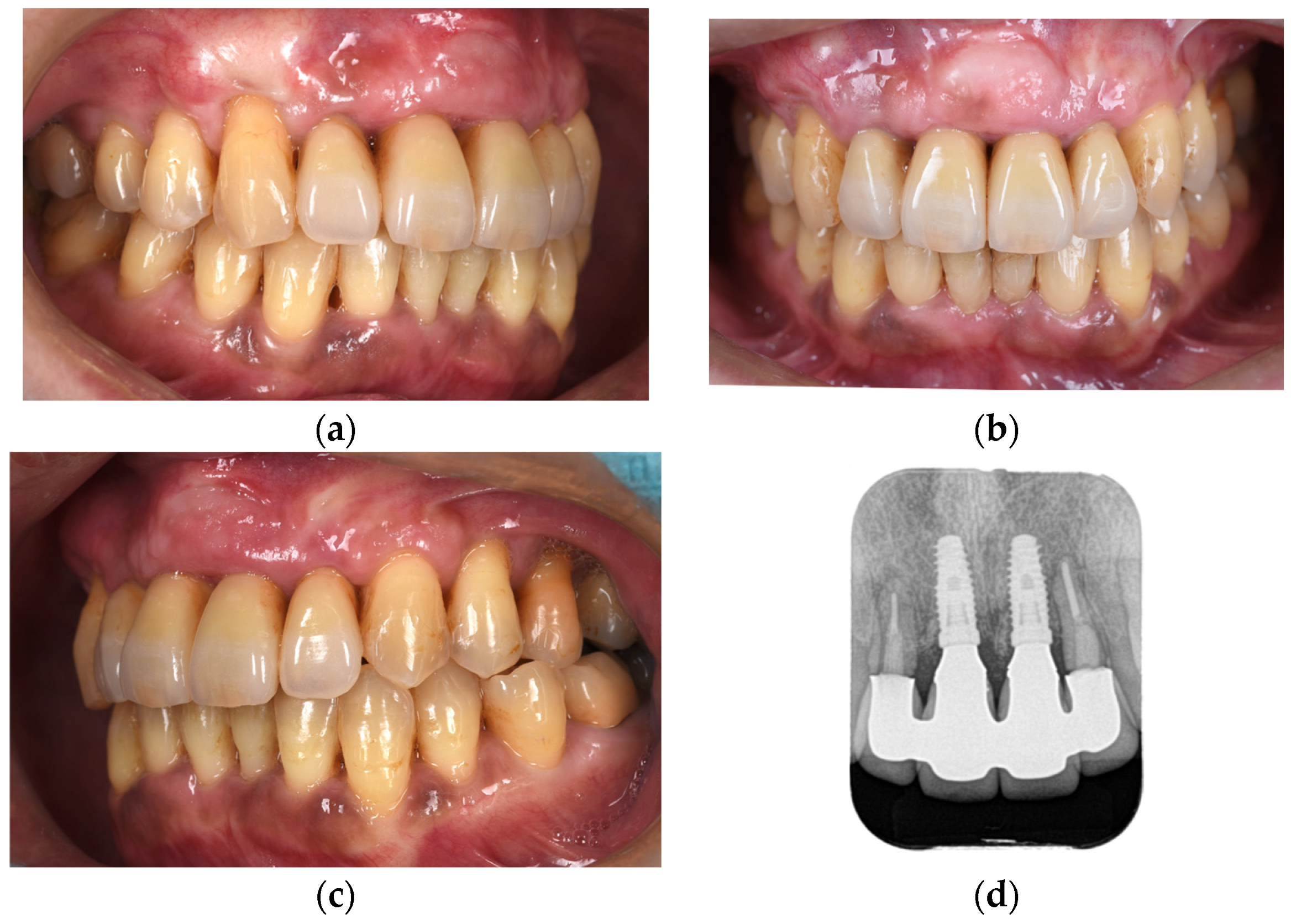 Diagnostics 15 00765 g012