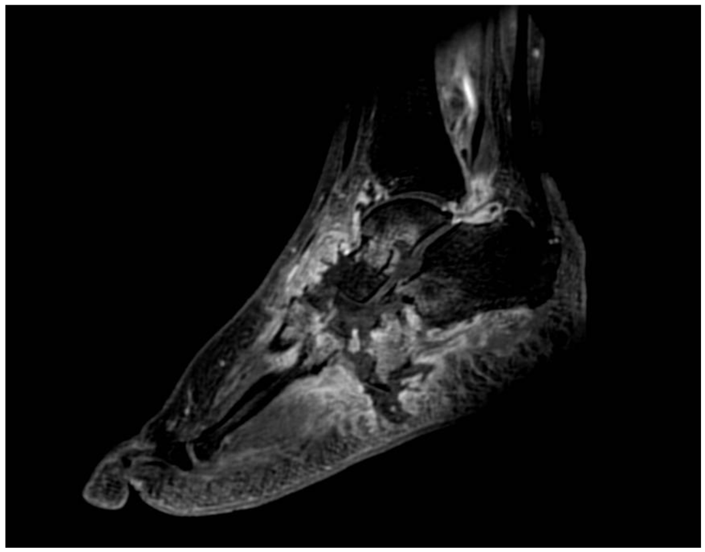 Diagnostics 15 00767 g004