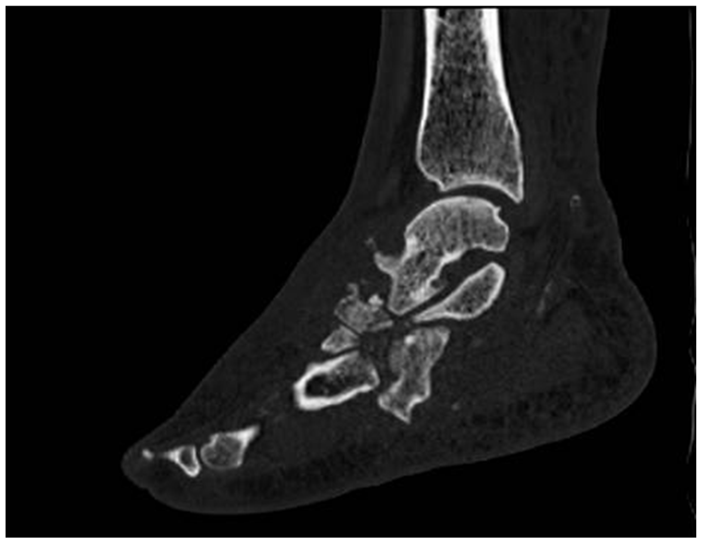 Diagnostics 15 00767 g007