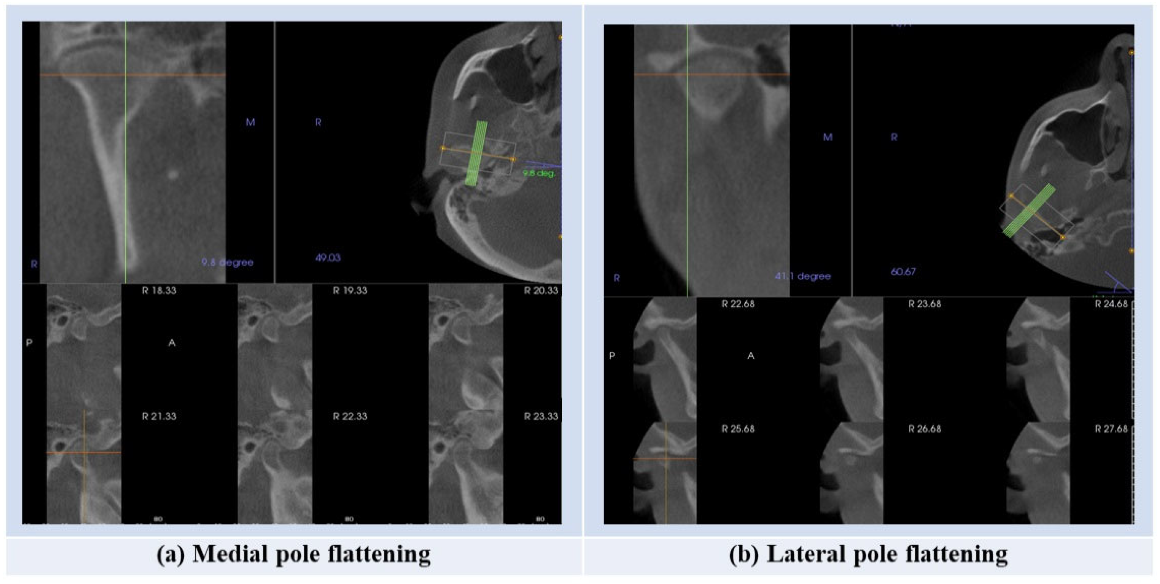 Diagnostics 15 00768 g002