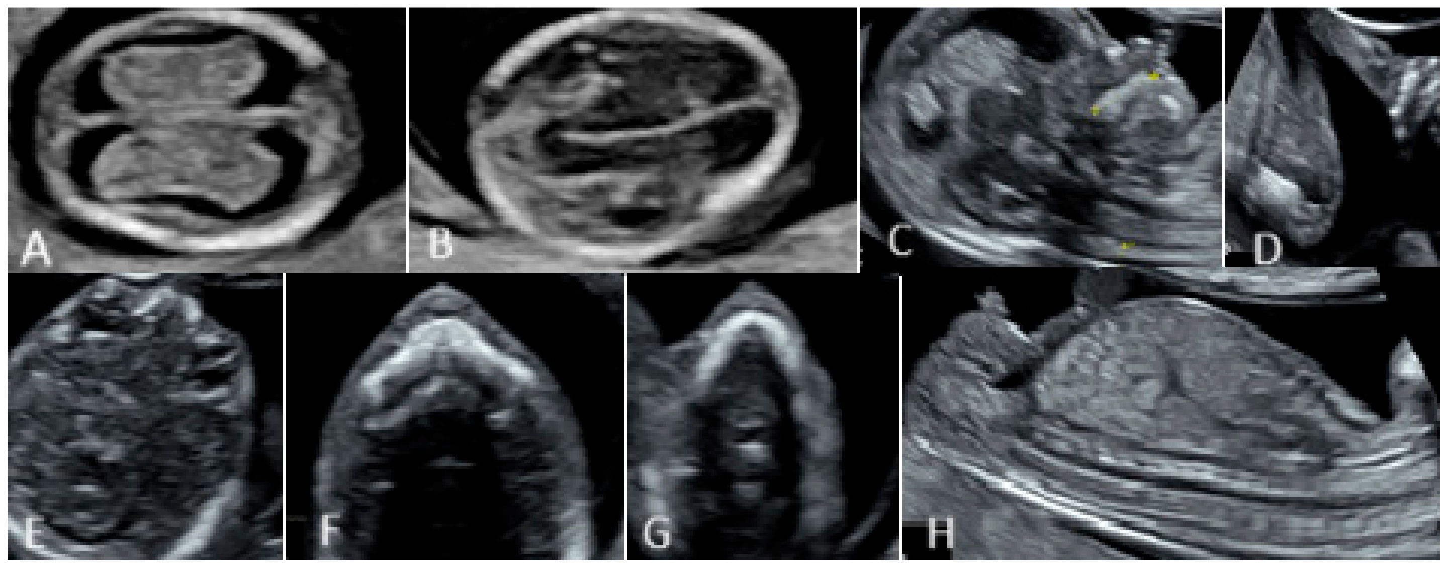Diagnostics 15 00769 g001