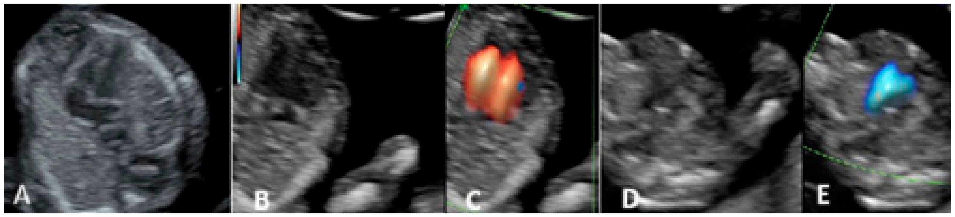 Diagnostics 15 00769 g002
