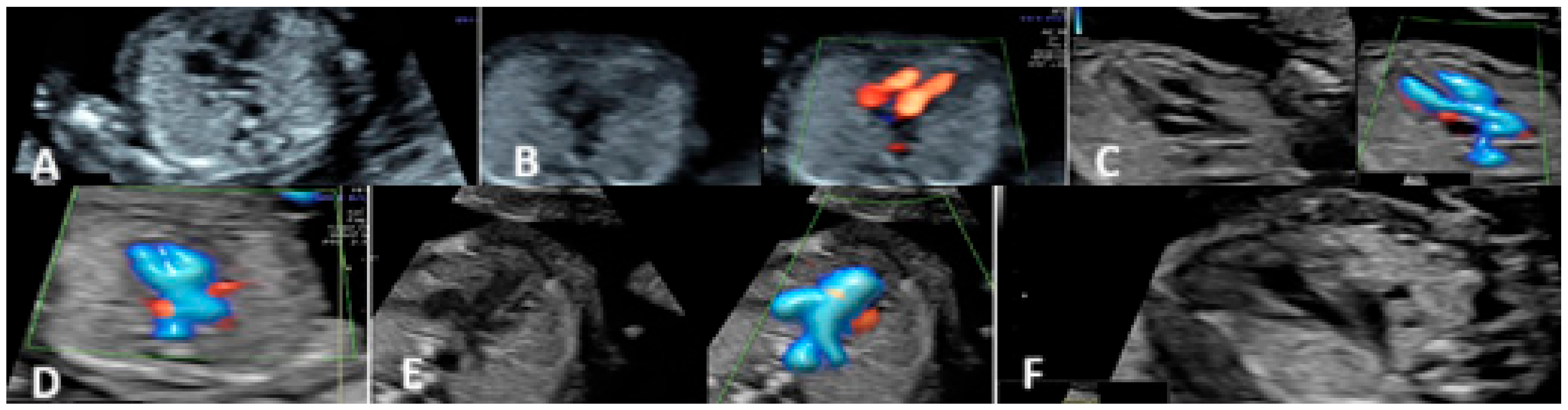 Diagnostics 15 00769 g003