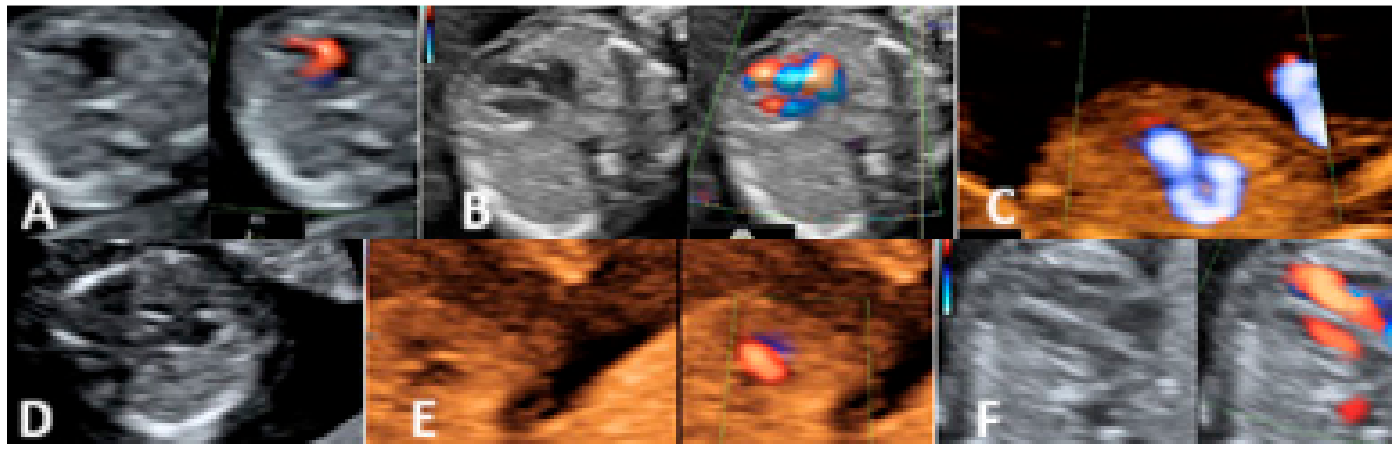 Diagnostics 15 00769 g004
