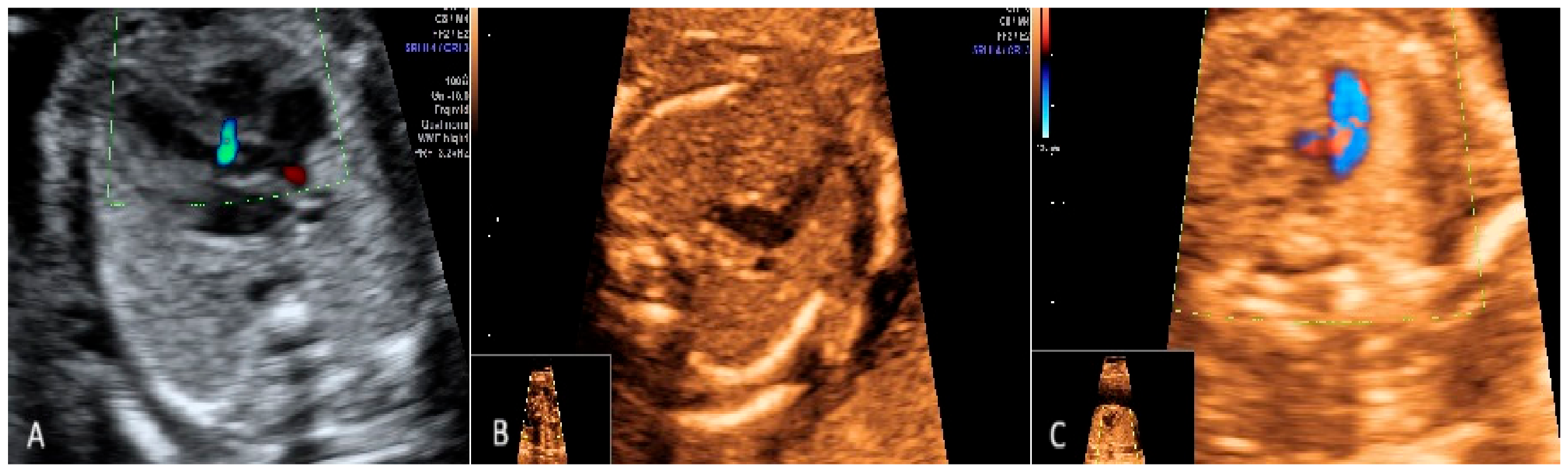 Diagnostics 15 00769 g005