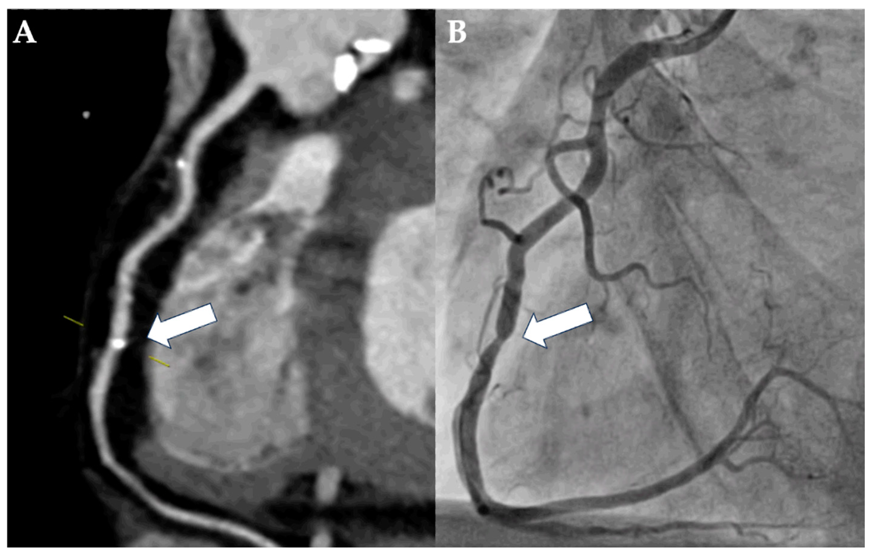Diagnostics 15 00771 g002