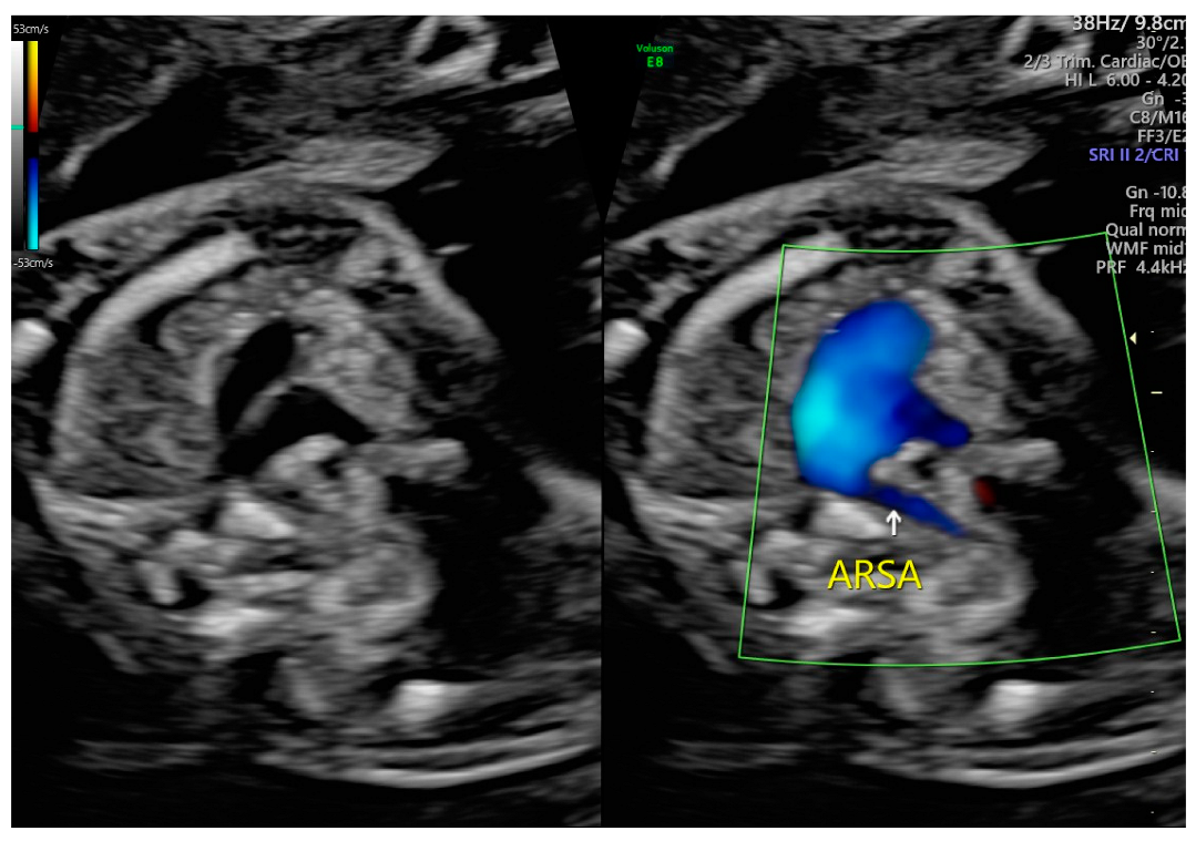 Diagnostics 15 00772 g001