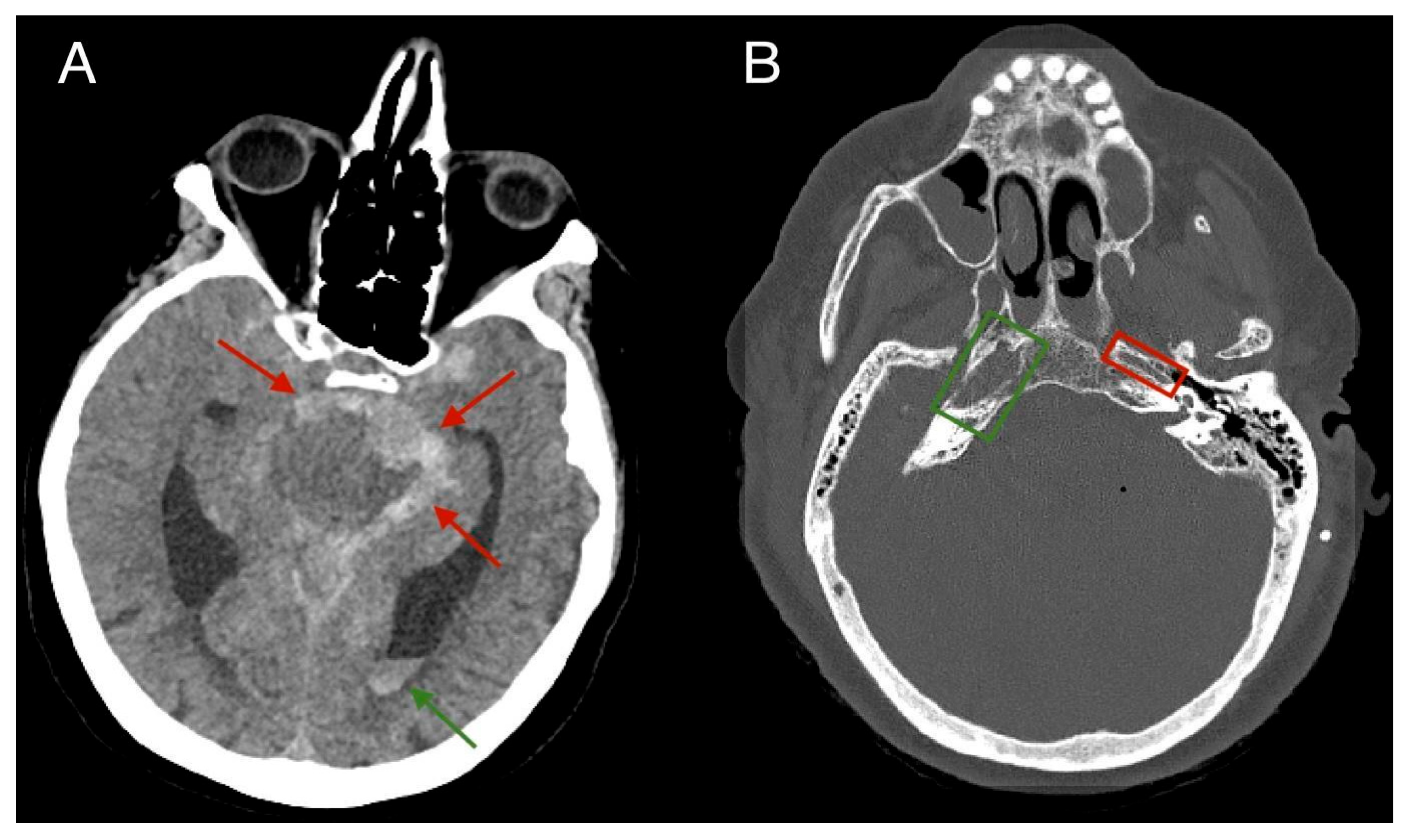 Diagnostics 15 00774 g001