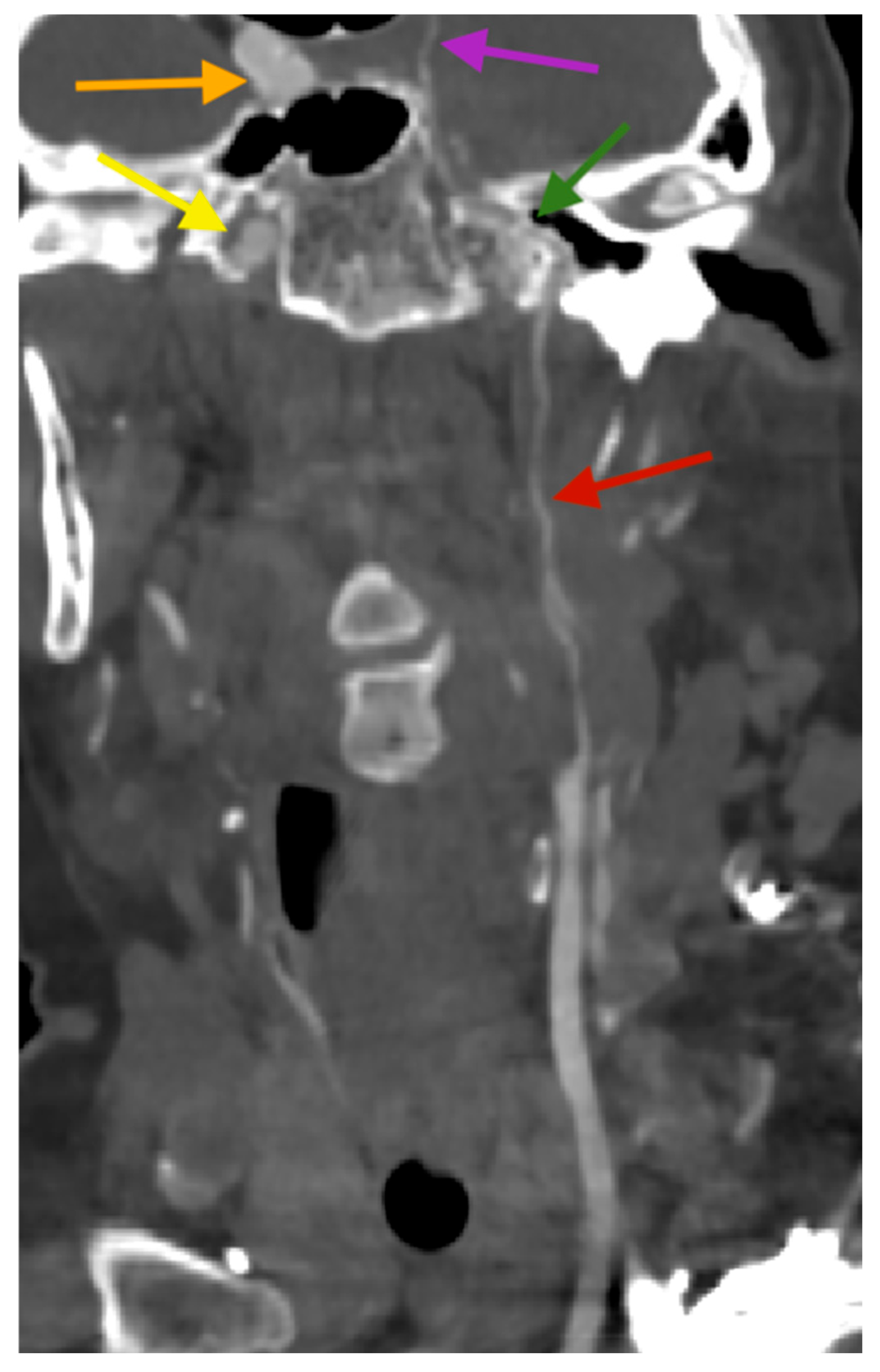 Diagnostics 15 00774 g003