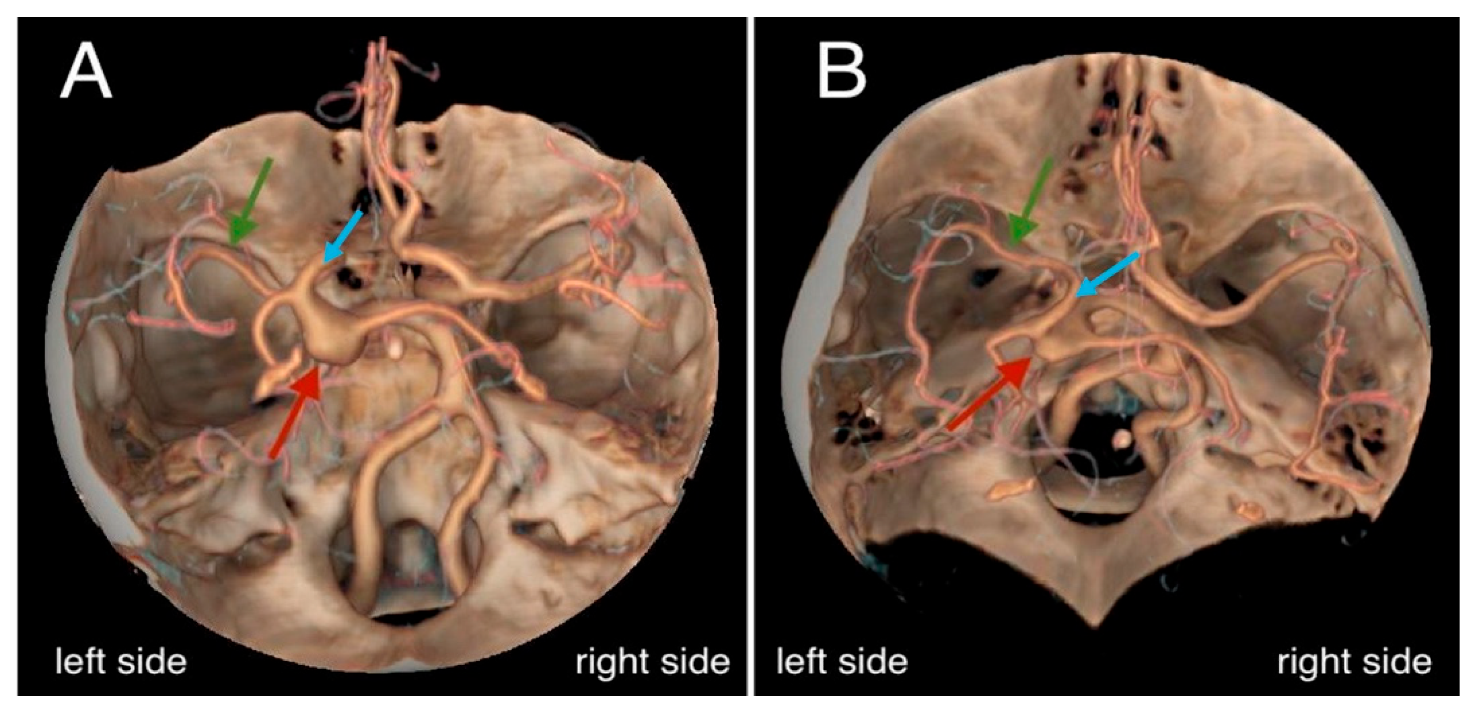 Diagnostics 15 00774 g004