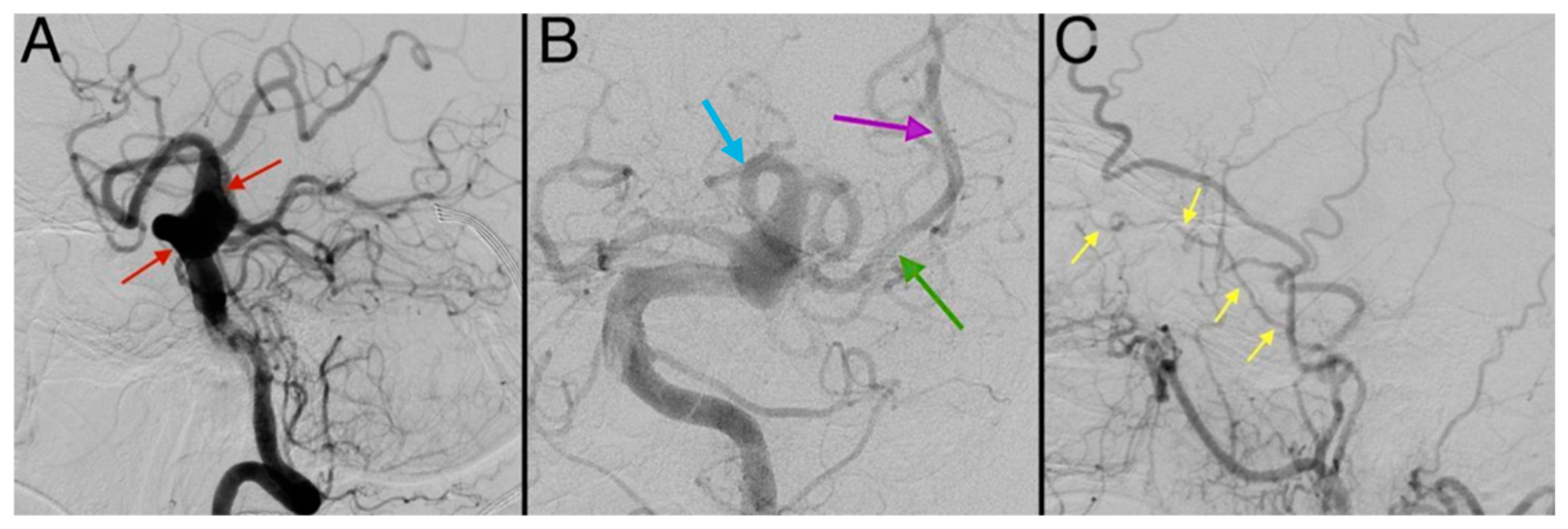 Diagnostics 15 00774 g005