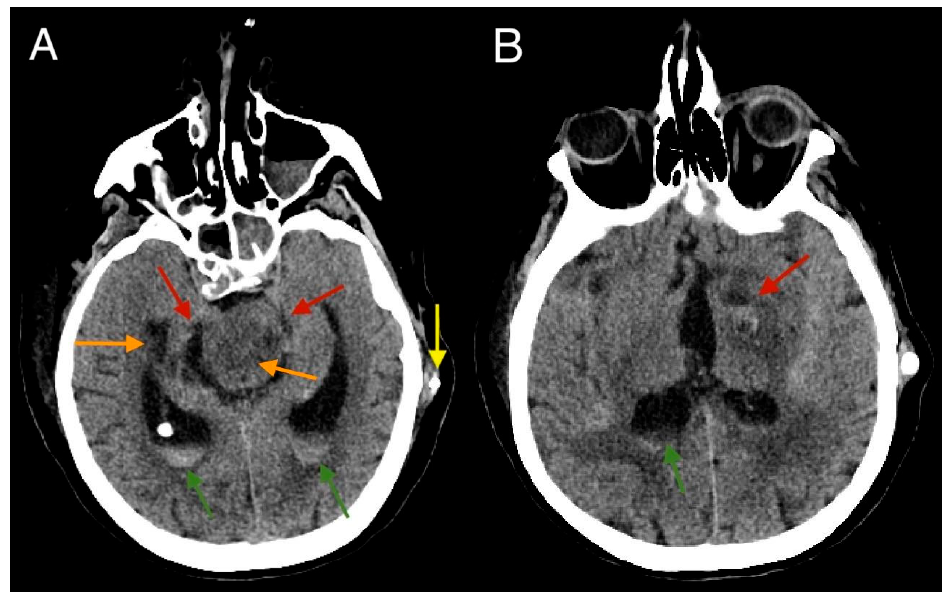 Diagnostics 15 00774 g006