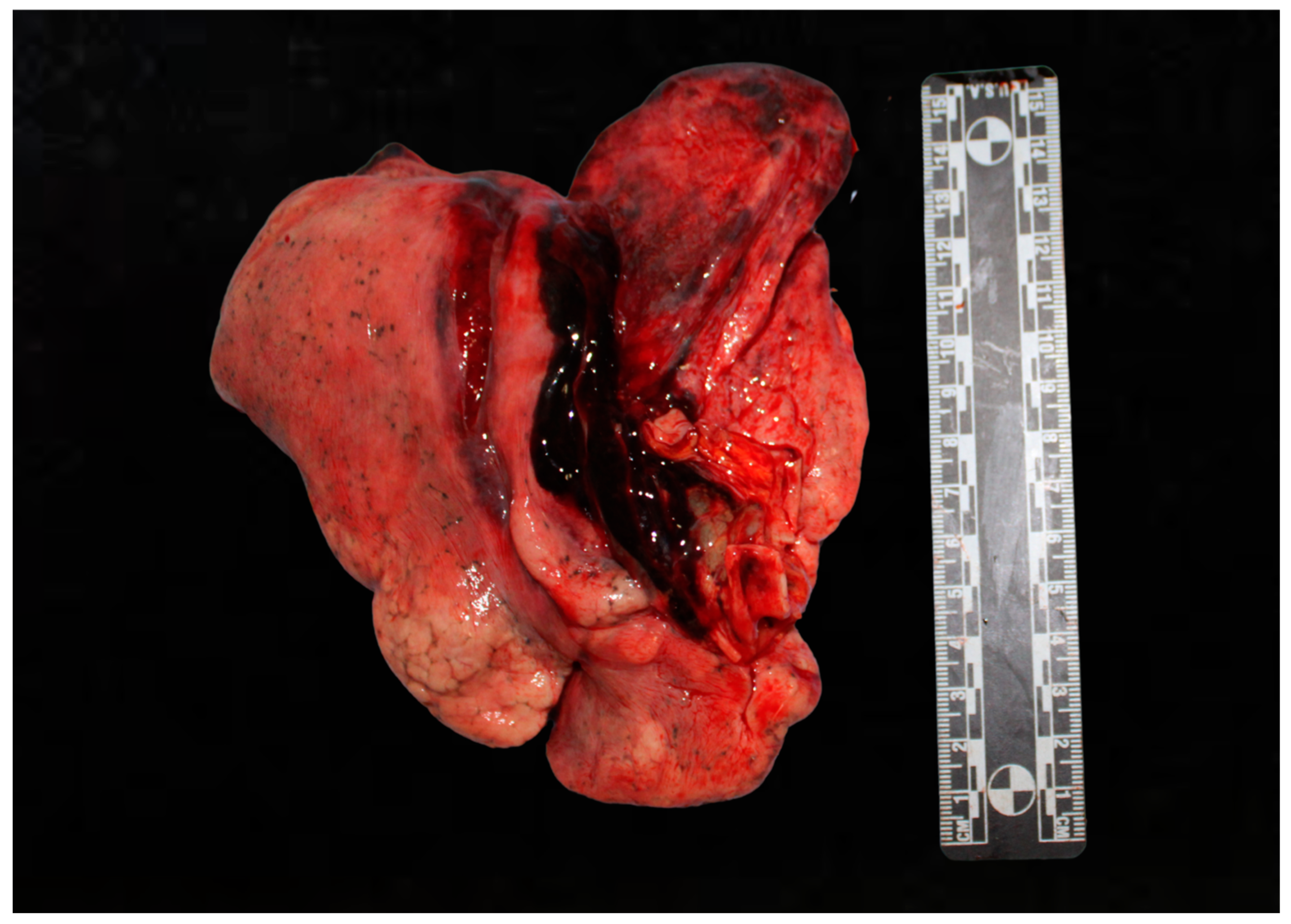 Diagnostics 15 00778 g001