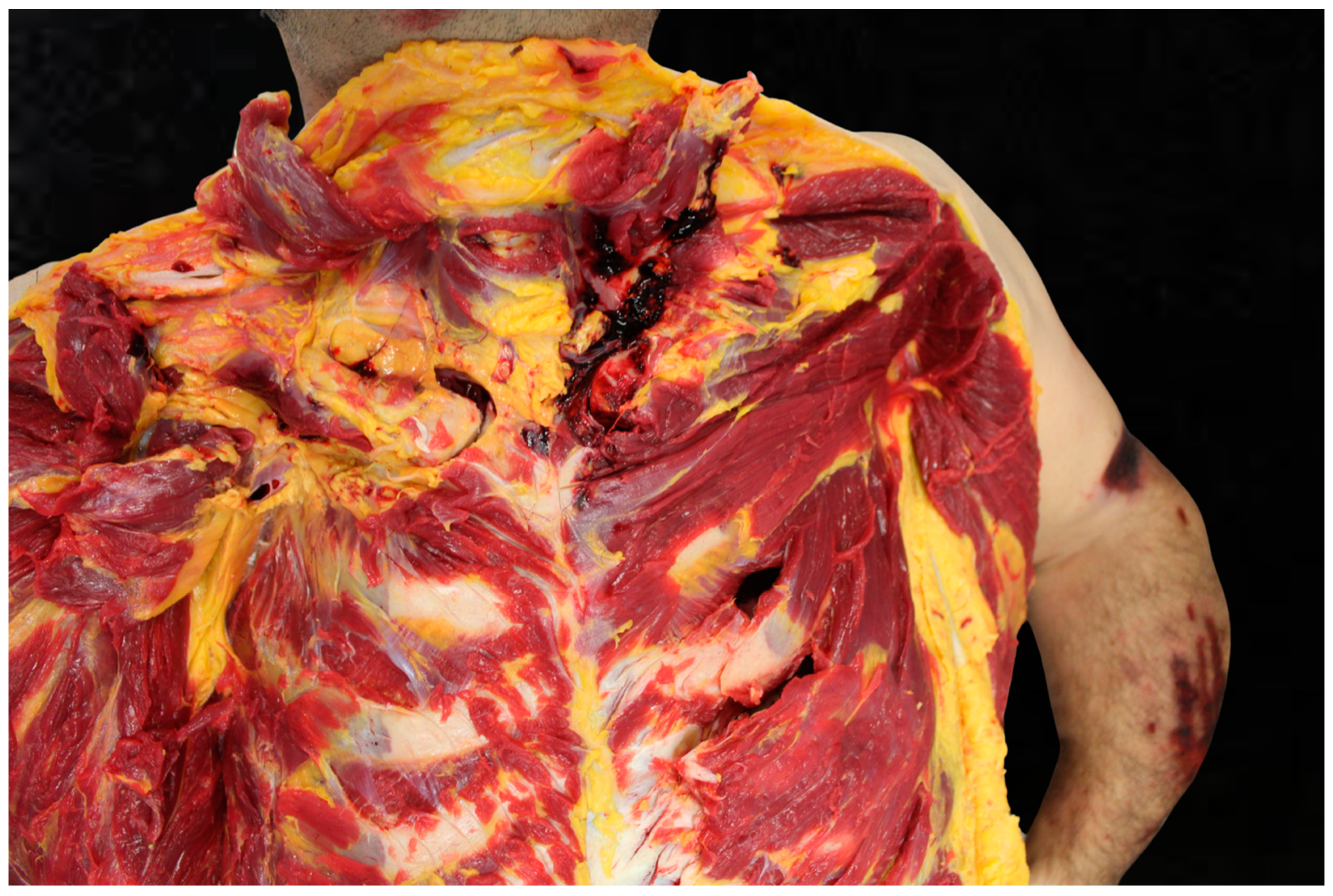 Diagnostics 15 00778 g004