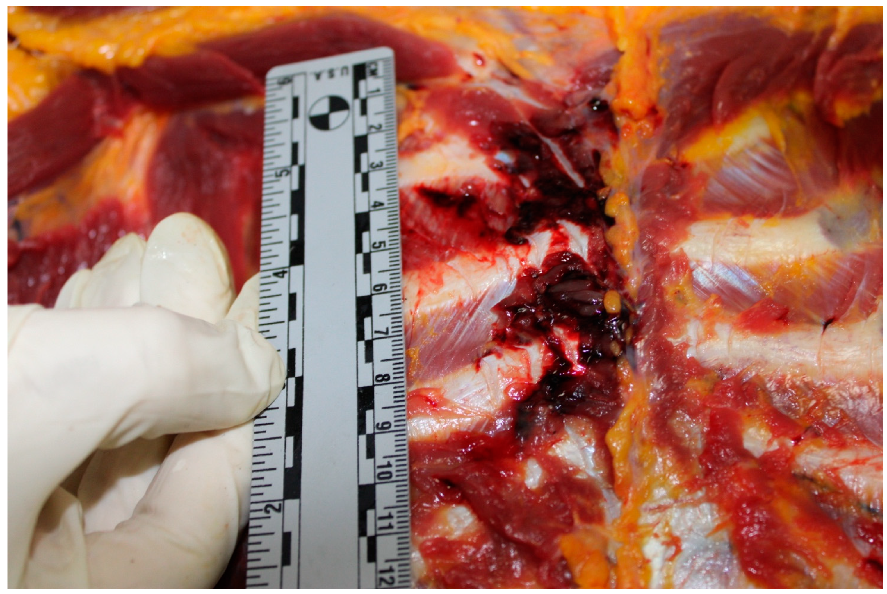 Diagnostics 15 00778 g005