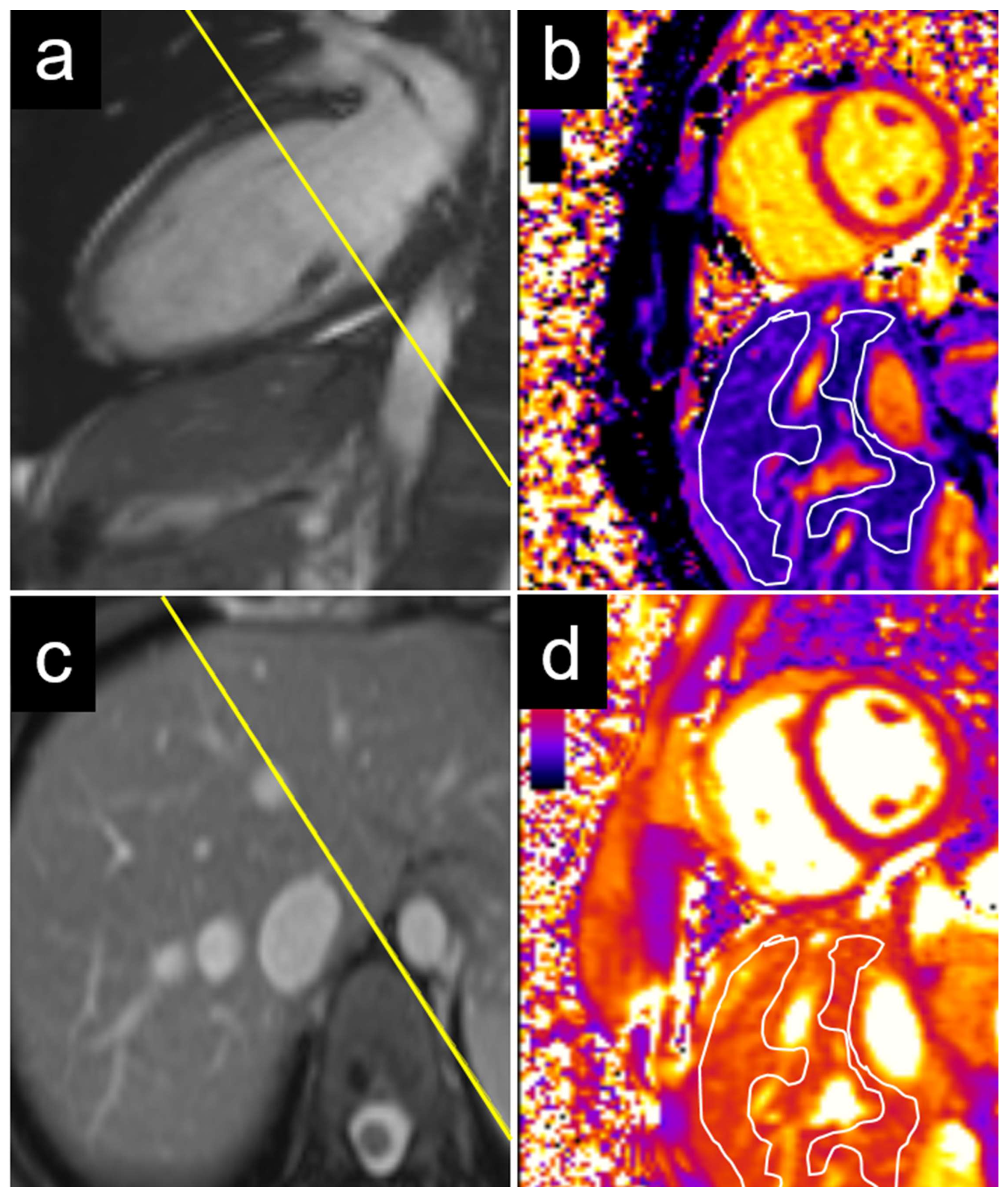 Diagnostics 15 00779 g004
