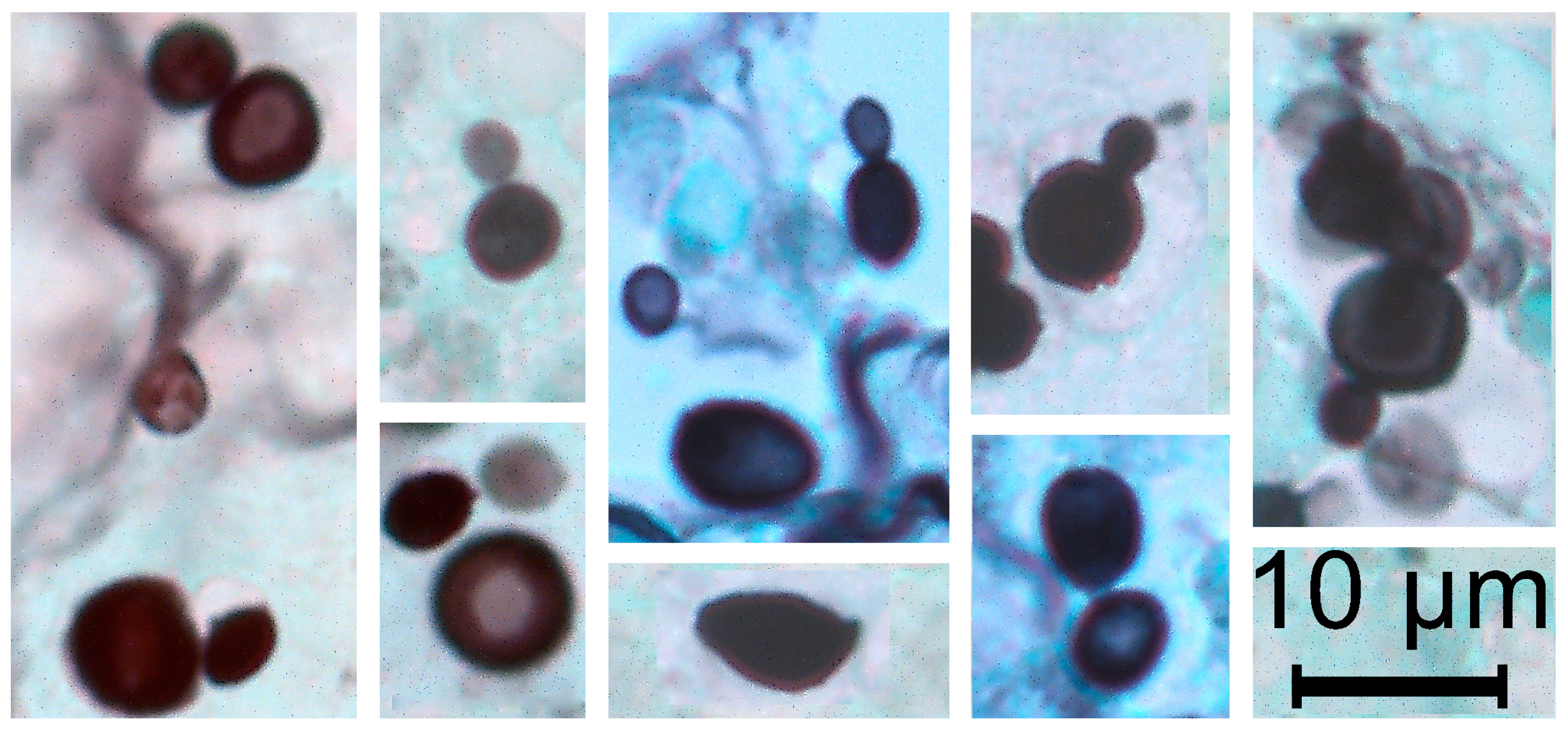 Diagnostics 15 00781 g002