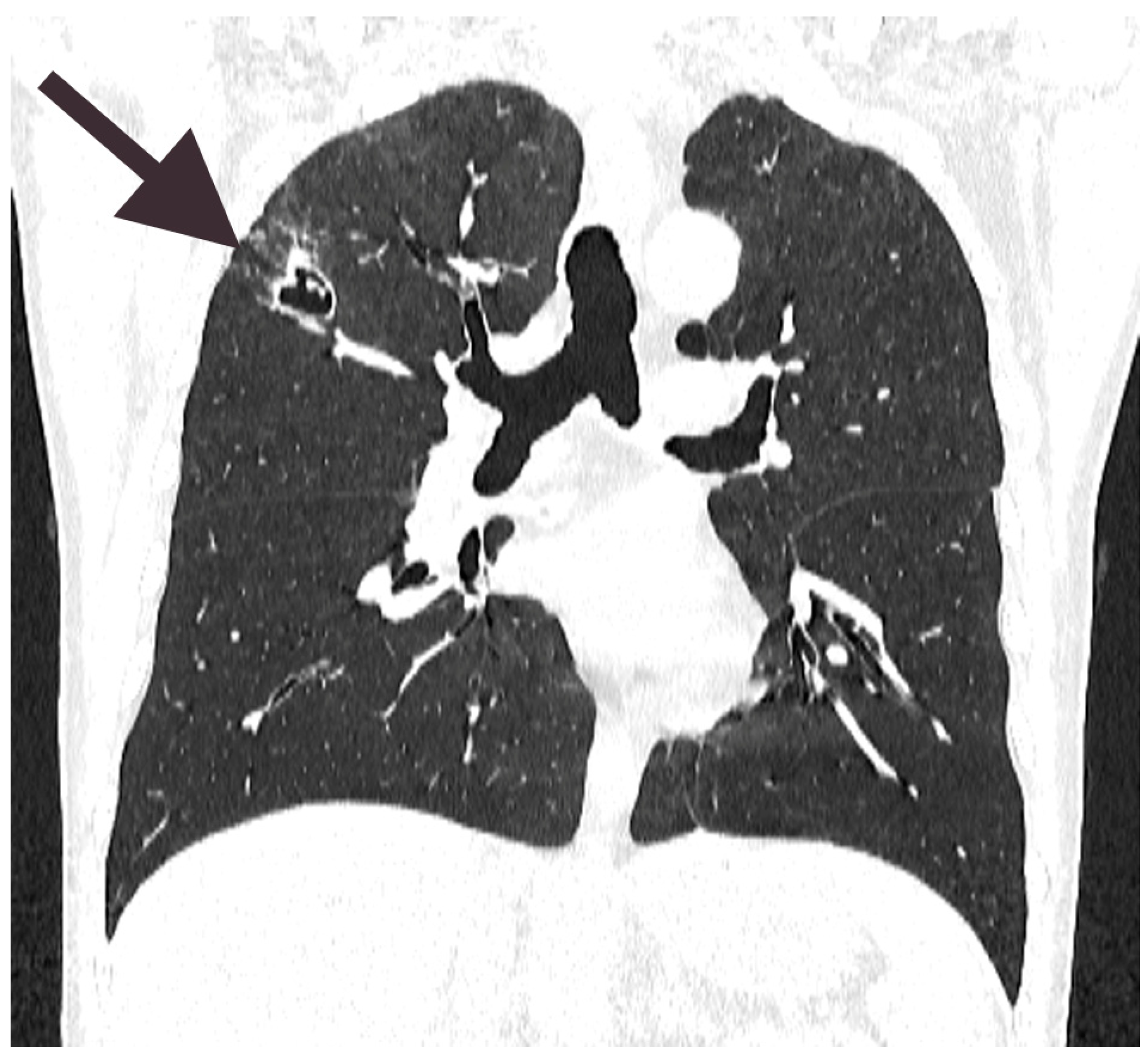 Diagnostics 15 00781 g004