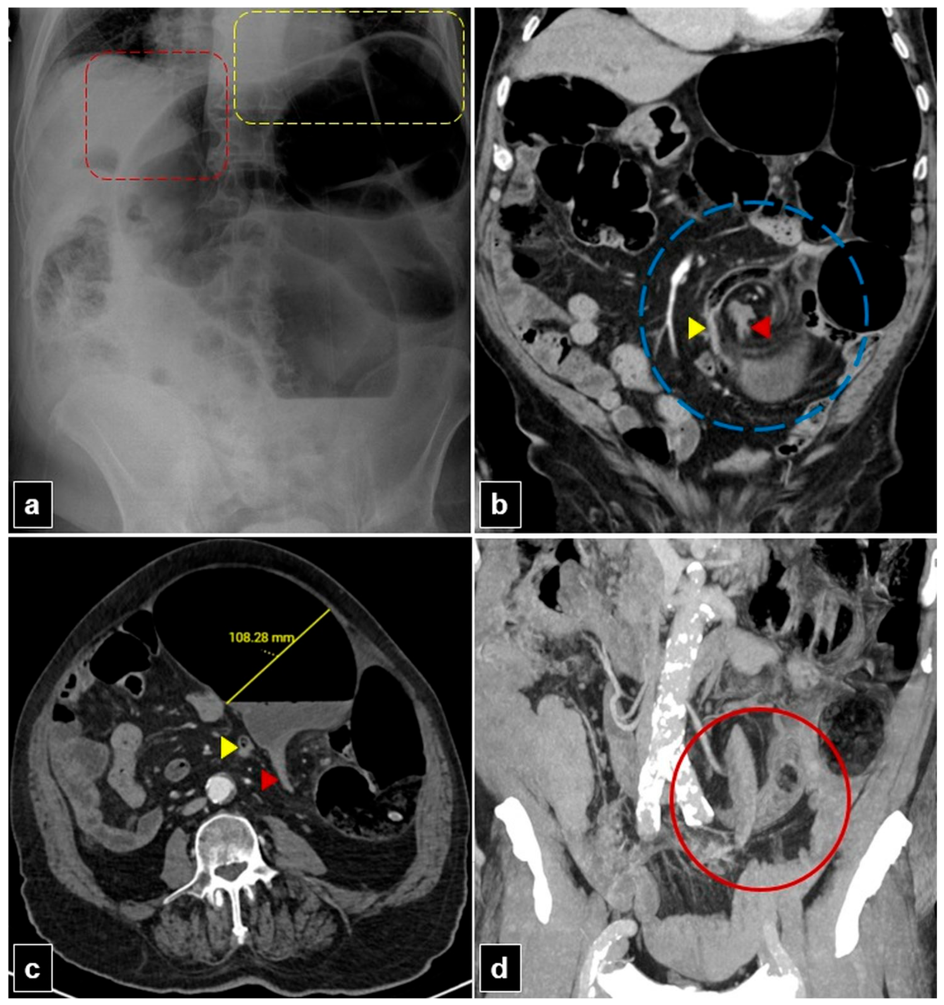 Diagnostics 15 00784 g003