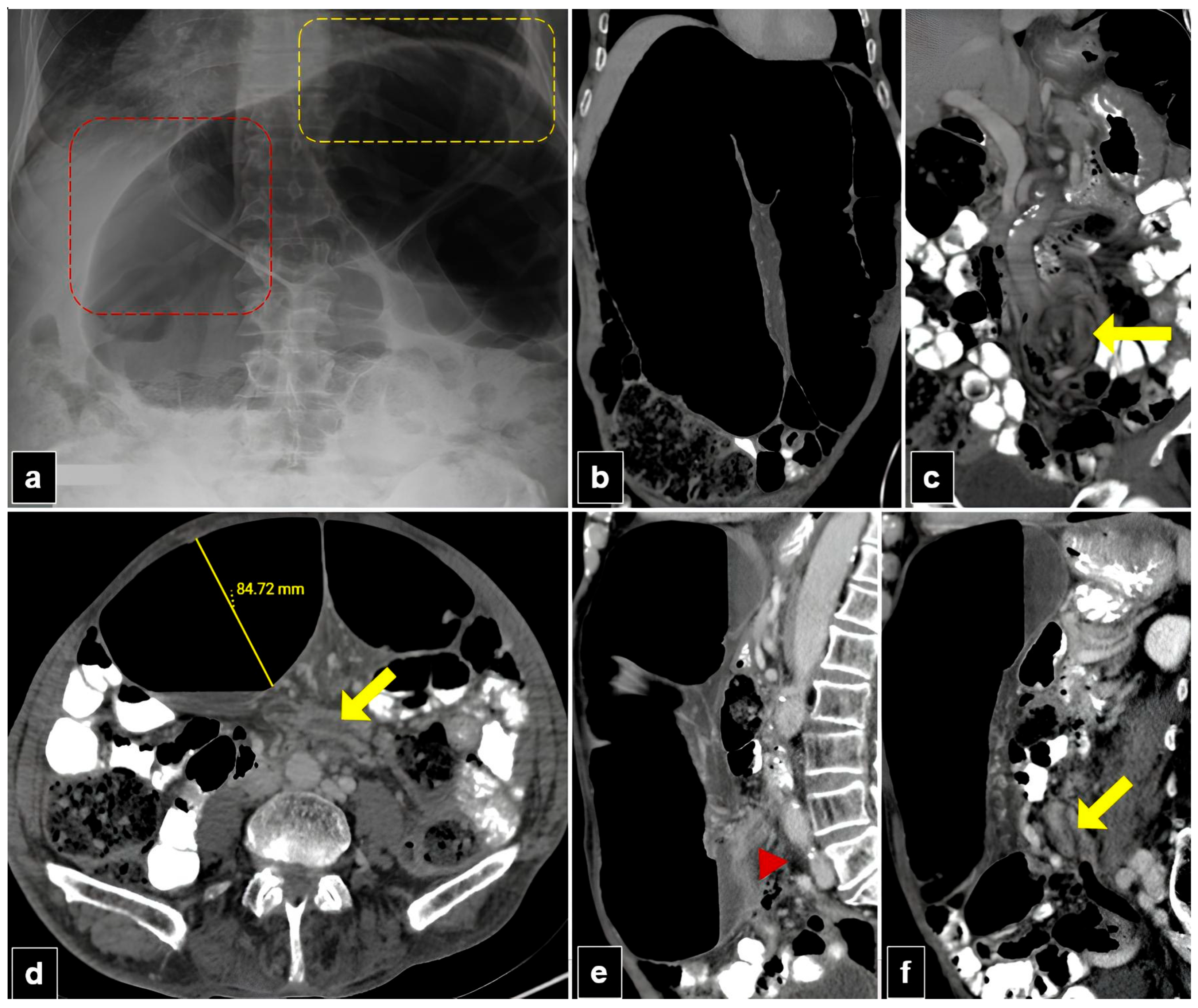 Diagnostics 15 00784 g004