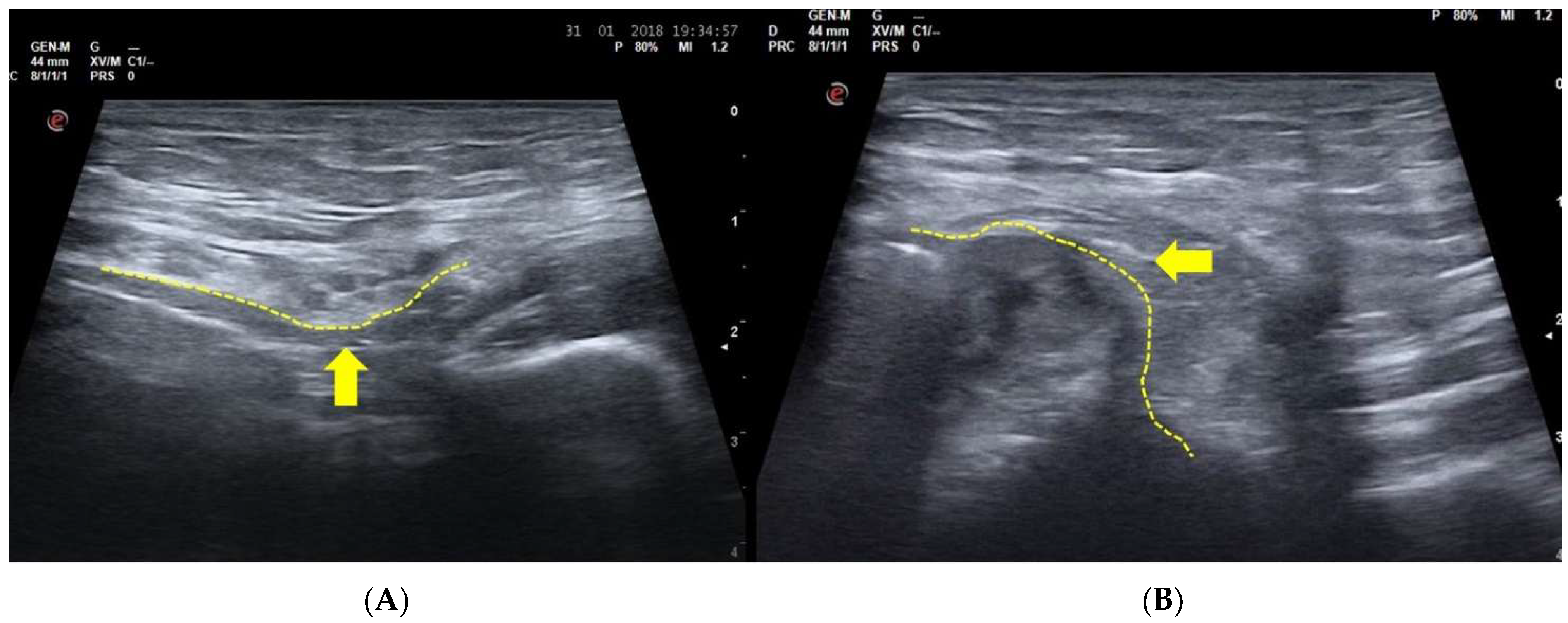 Diagnostics 15 00785 g003