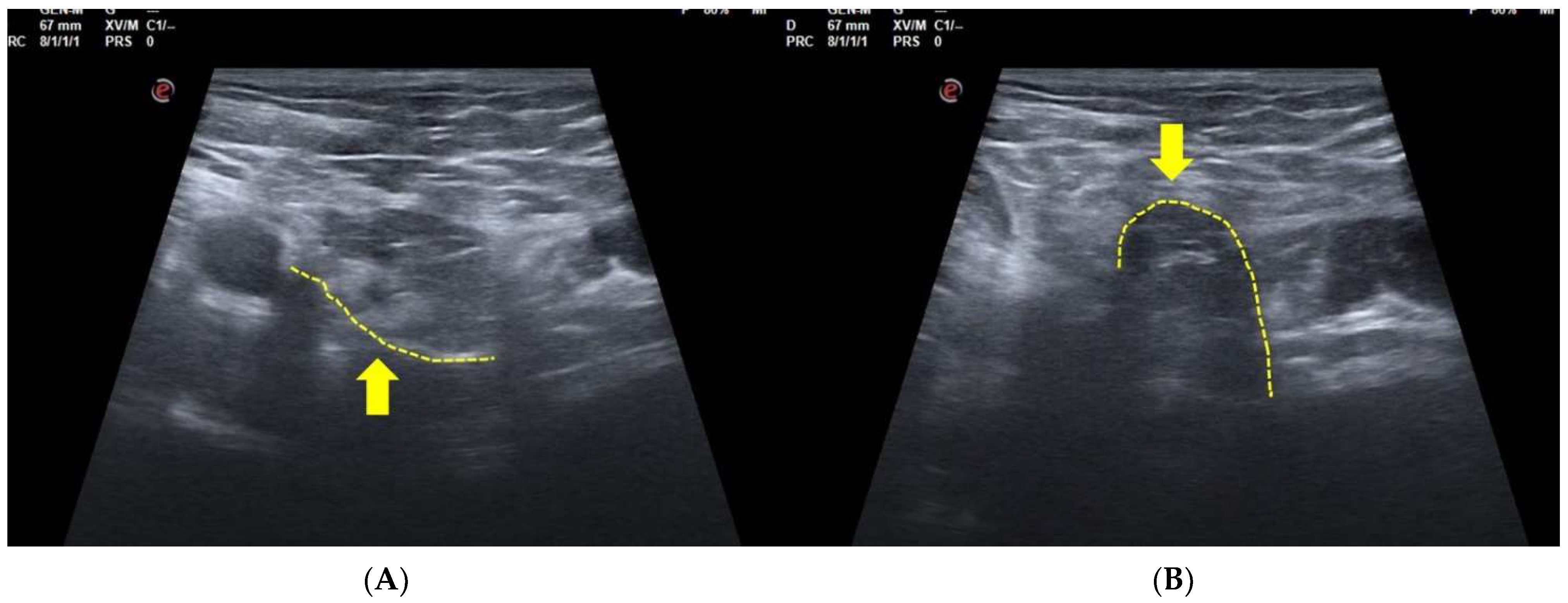 Diagnostics 15 00785 g004