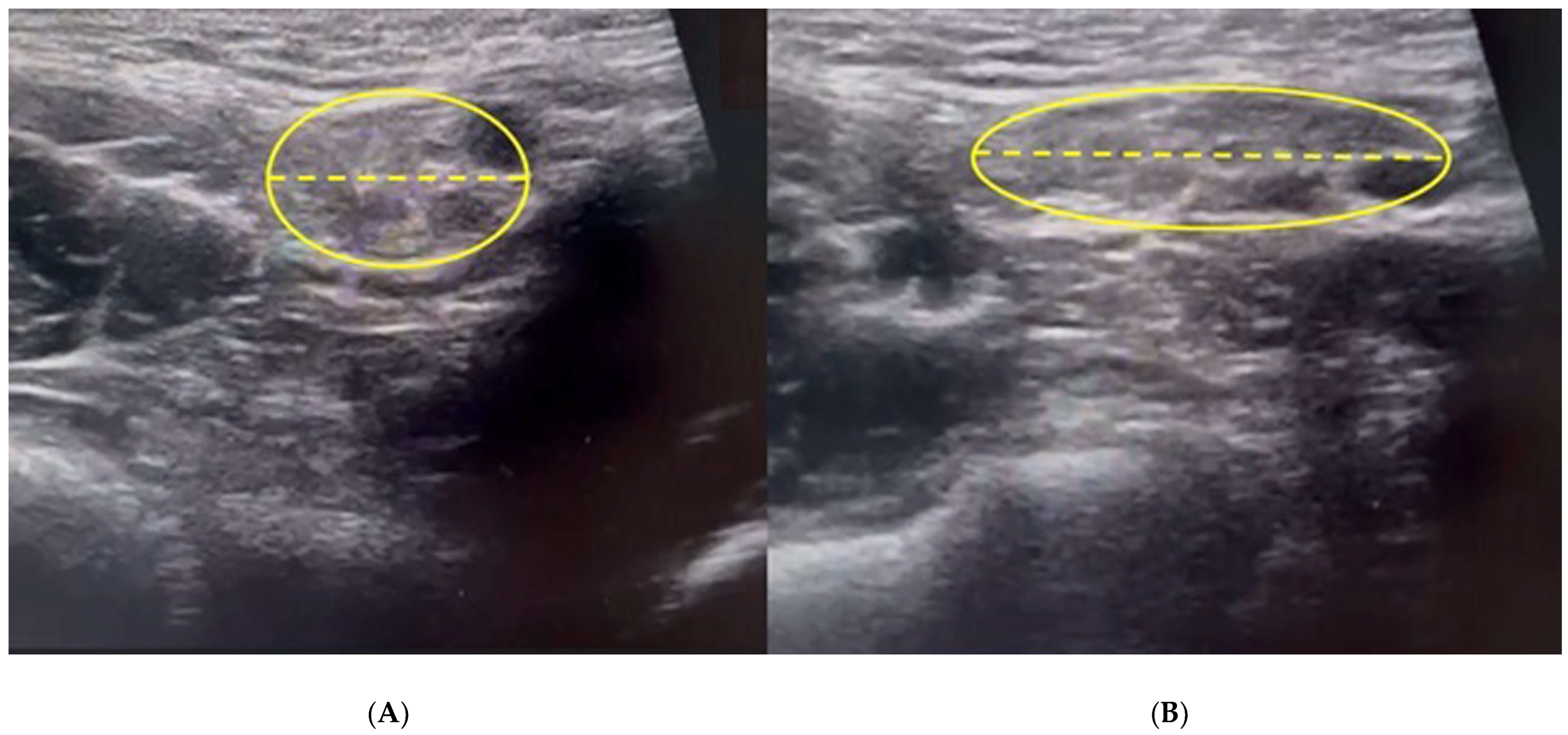 Diagnostics 15 00785 g006